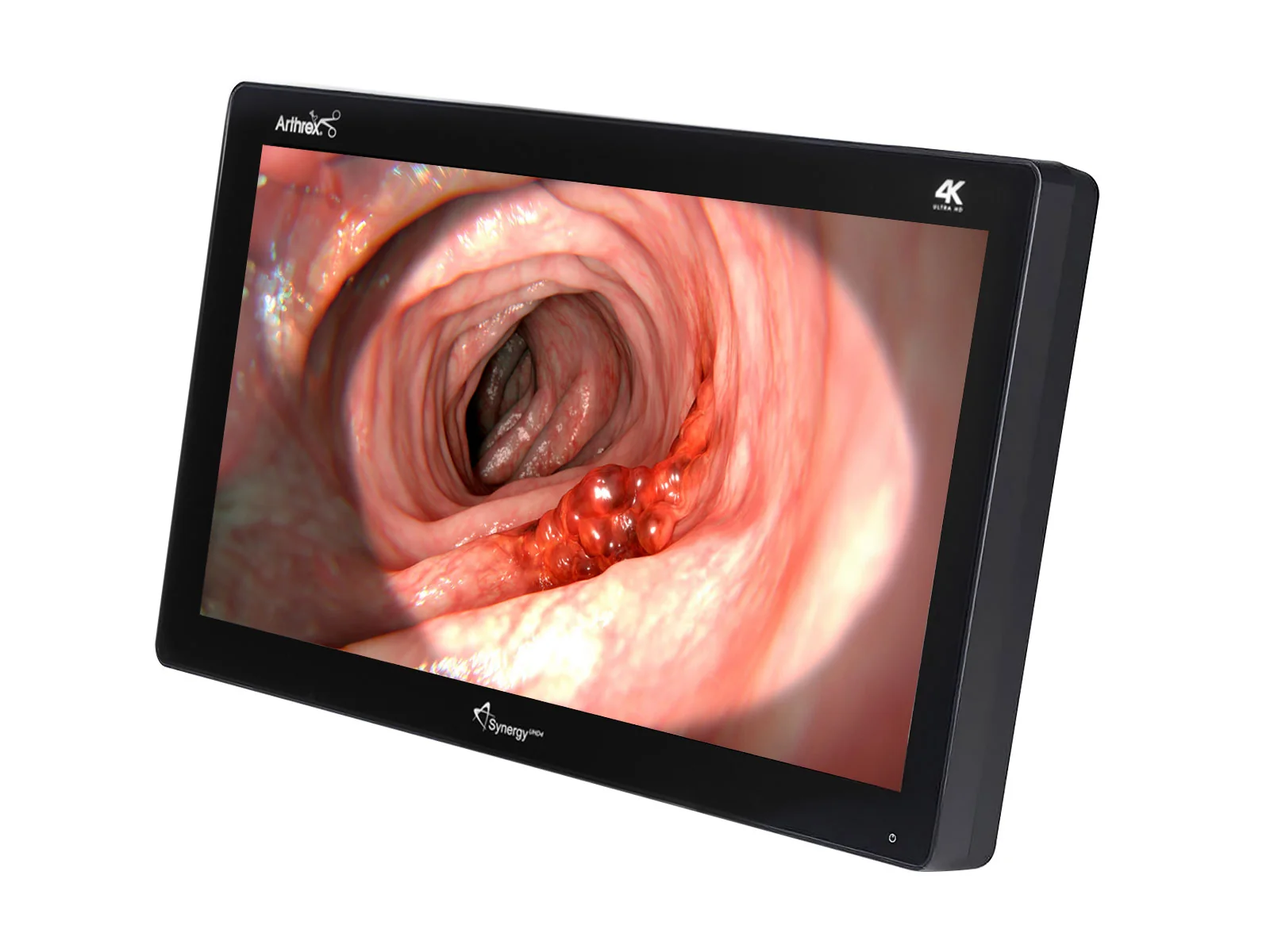 Barco Arthrex SynergyUHD4 32" 4K Surgical Medical Display Monitor (AR-3250-3210) - Image 2