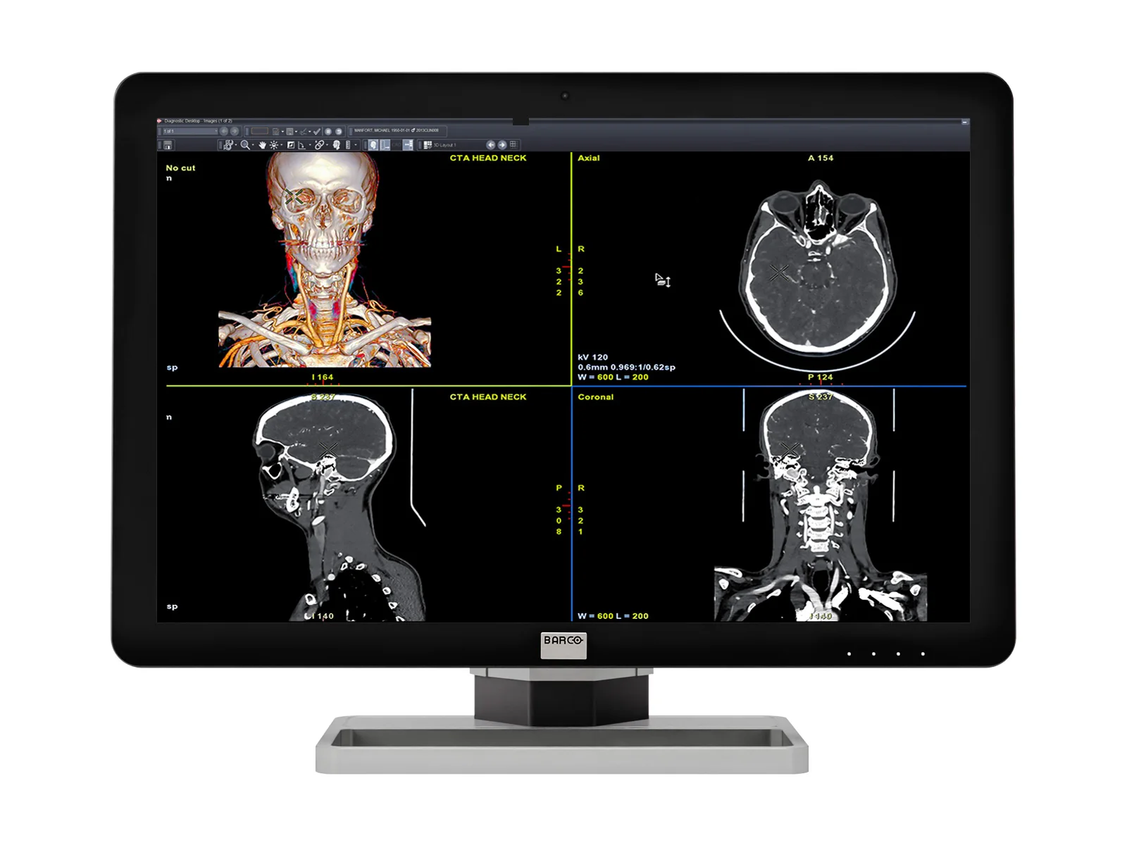 Barco Coronis Fusion MDCC-6430 6MP 30" Color General Radiology PACS Display