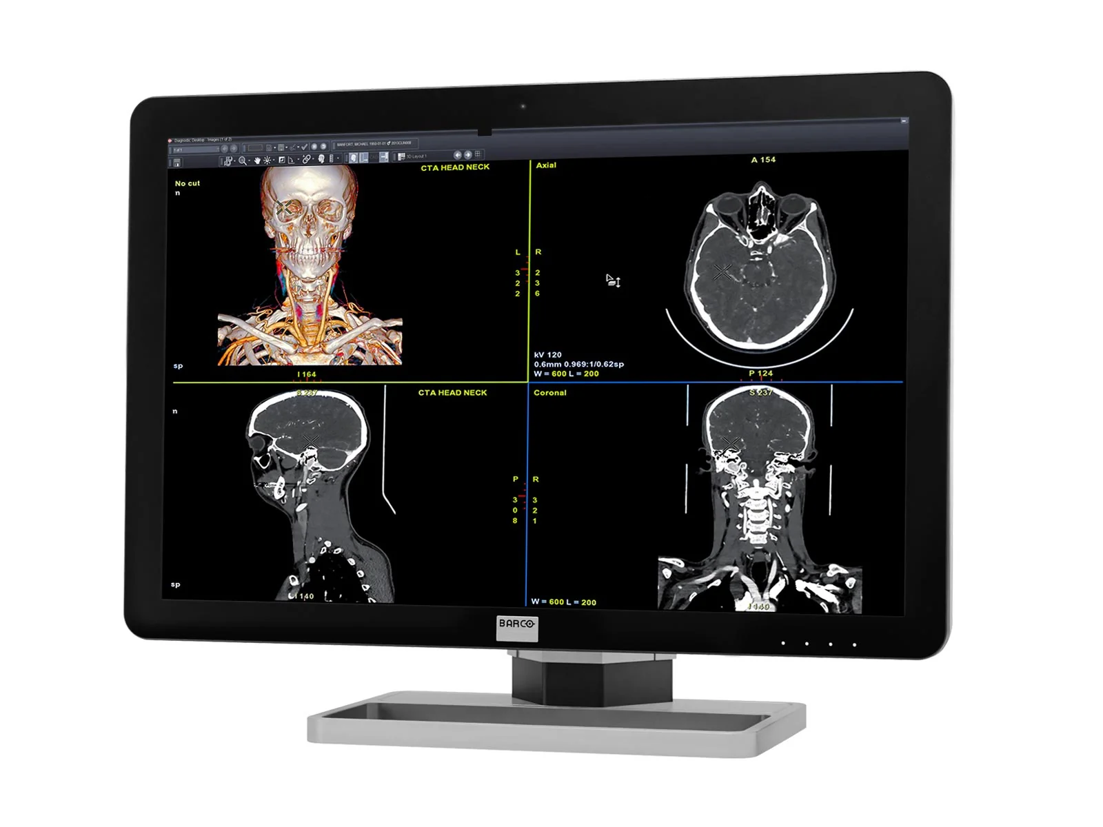 Barco Coronis Fusion MDCC-6430 6MP 30" Color General Radiology PACS Display - Image 2