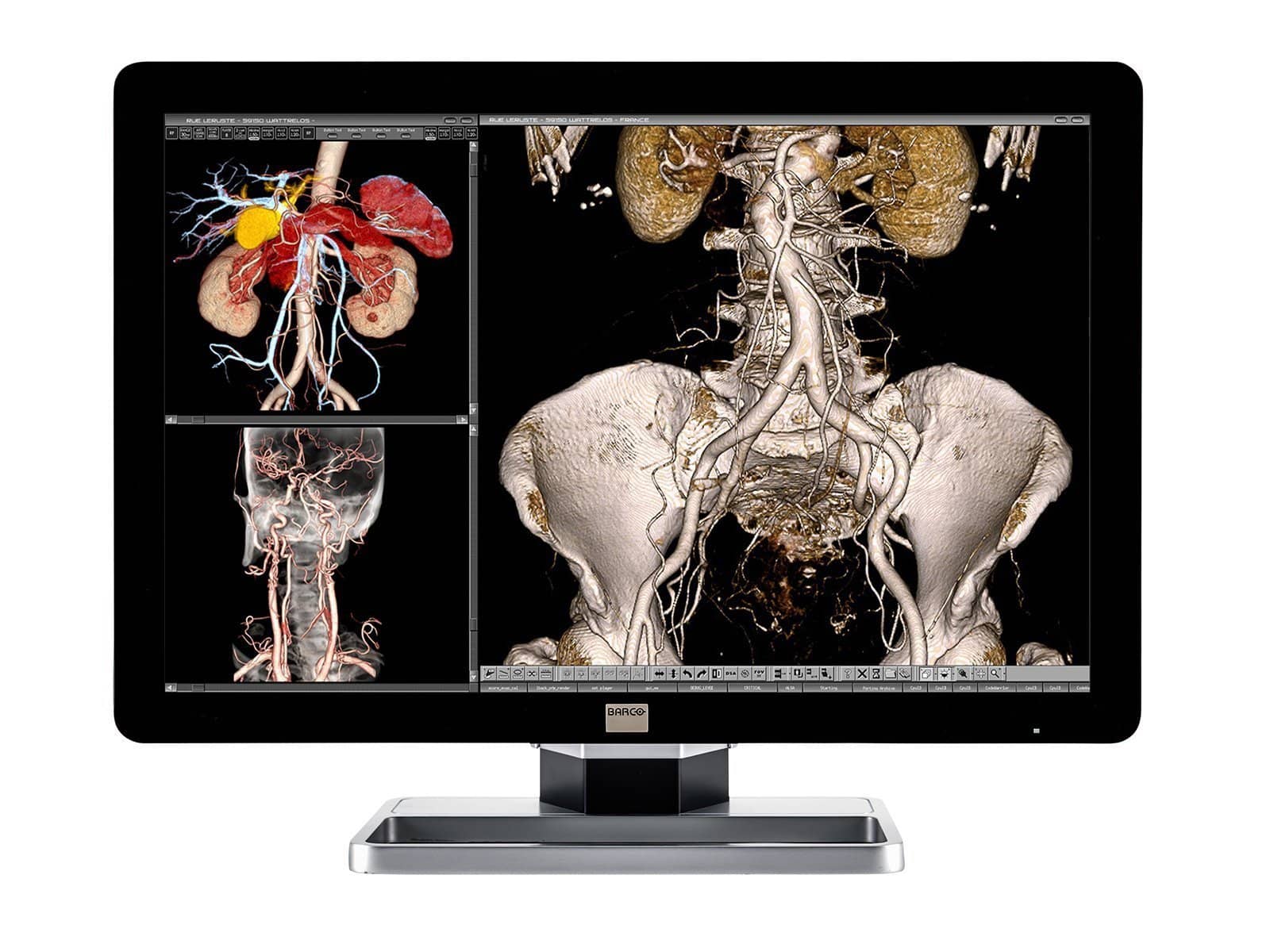 Barco Coronis Fusion MDCC-4330 4MP 30" Color General Radiology PACS Display