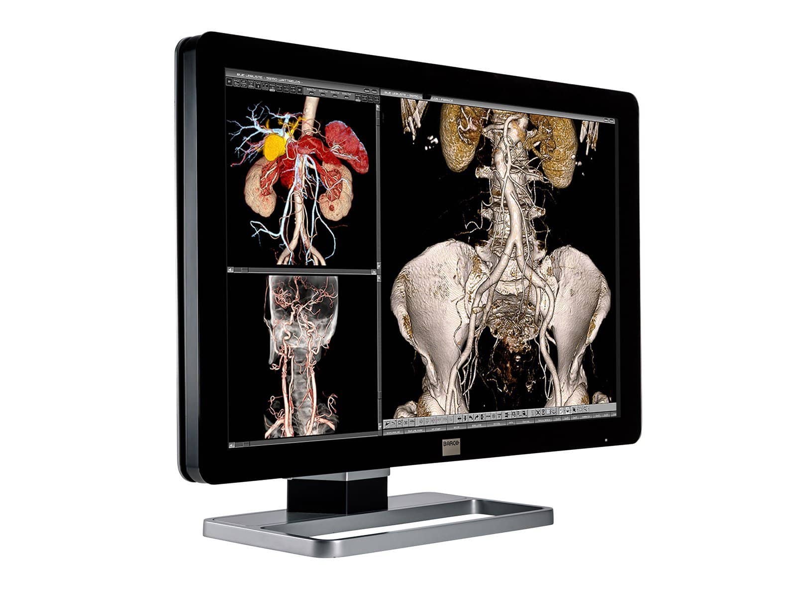 Barco Coronis Fusion MDCC-4330 4MP 30" Color General Radiology PACS Display - Image 2