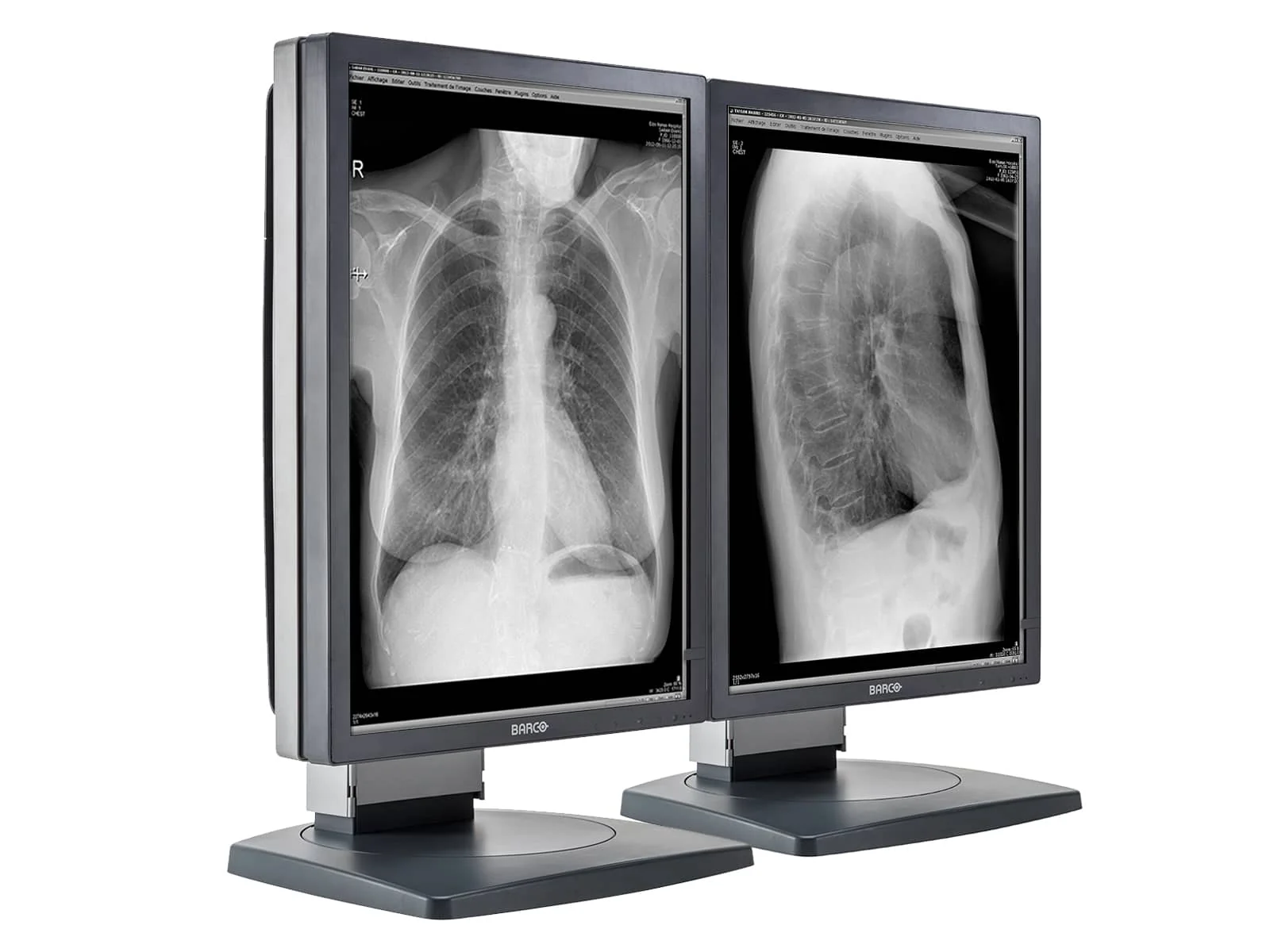 Barco Coronis MDCG-2121 2MP 21" Grayscale Diagnostic Radiology PACS Monitor - Image 2