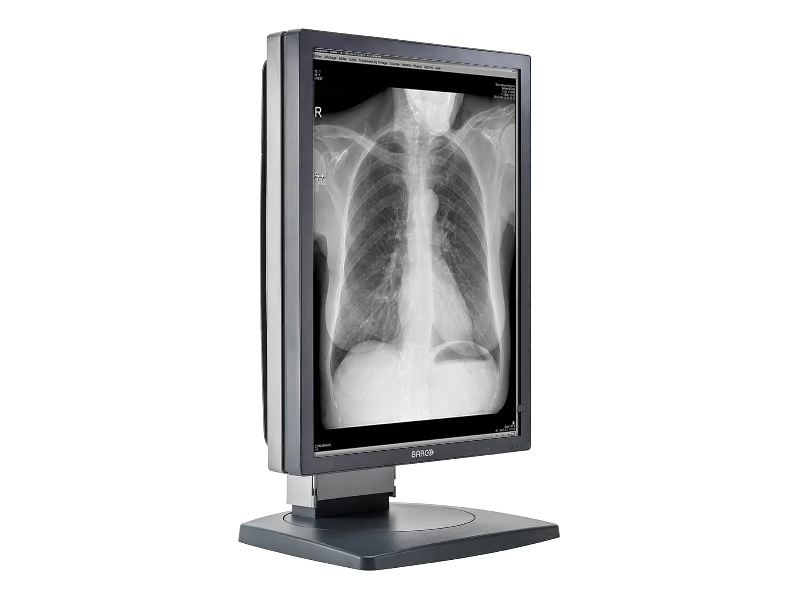 Barco Coronis MDCG-3120 3MP 20.8" Grayscale General Radiology Diagnostic Display - Image 6