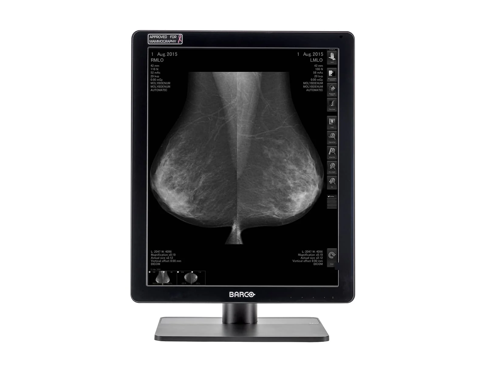 Barco Coronis MDCG-5221 5MP 21" Grayscale Mammo 3D-DBT Breast Imaging Display - Image 3