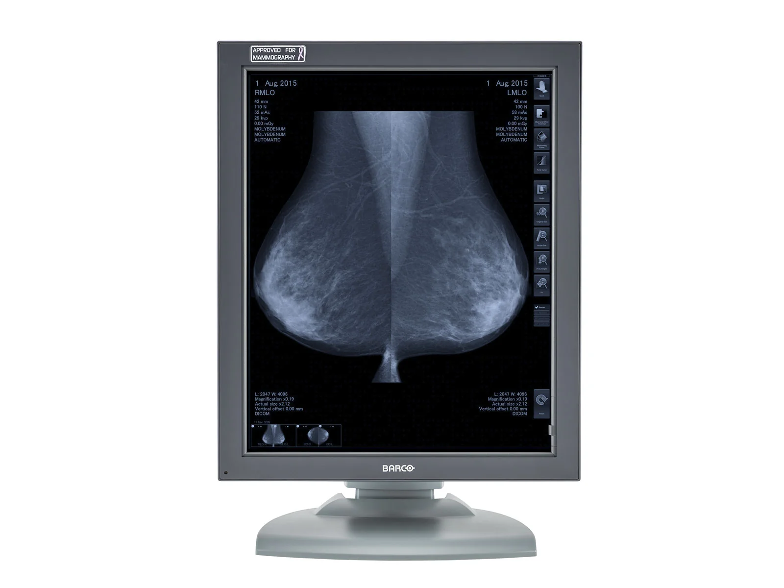 Barco Coronis MDMG-5121 5MP 21" Grayscale Breast Imaging PACS Mammography Display - Image 3