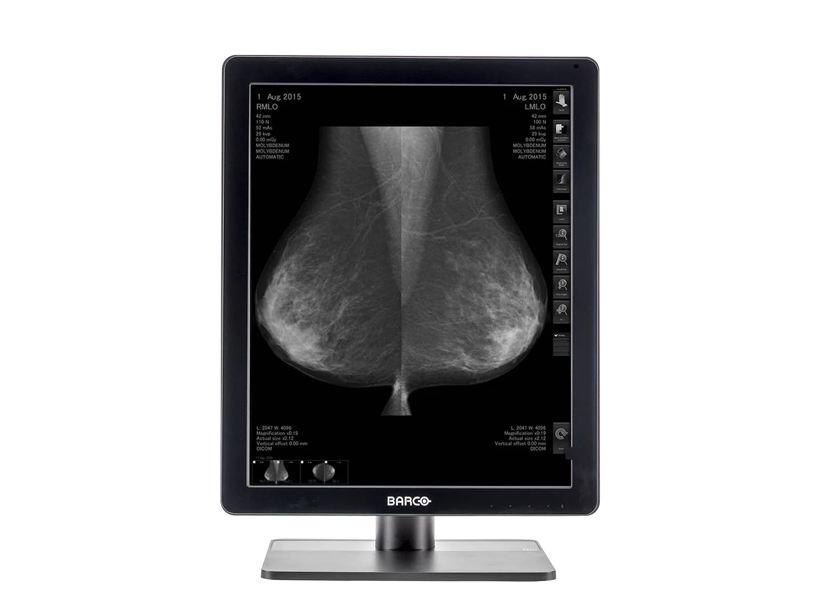 Barco Nio MDNG-5221 5MP 21" Grayscale 3D-DBT Mammography Breast Imaging PACS Display - Image 3