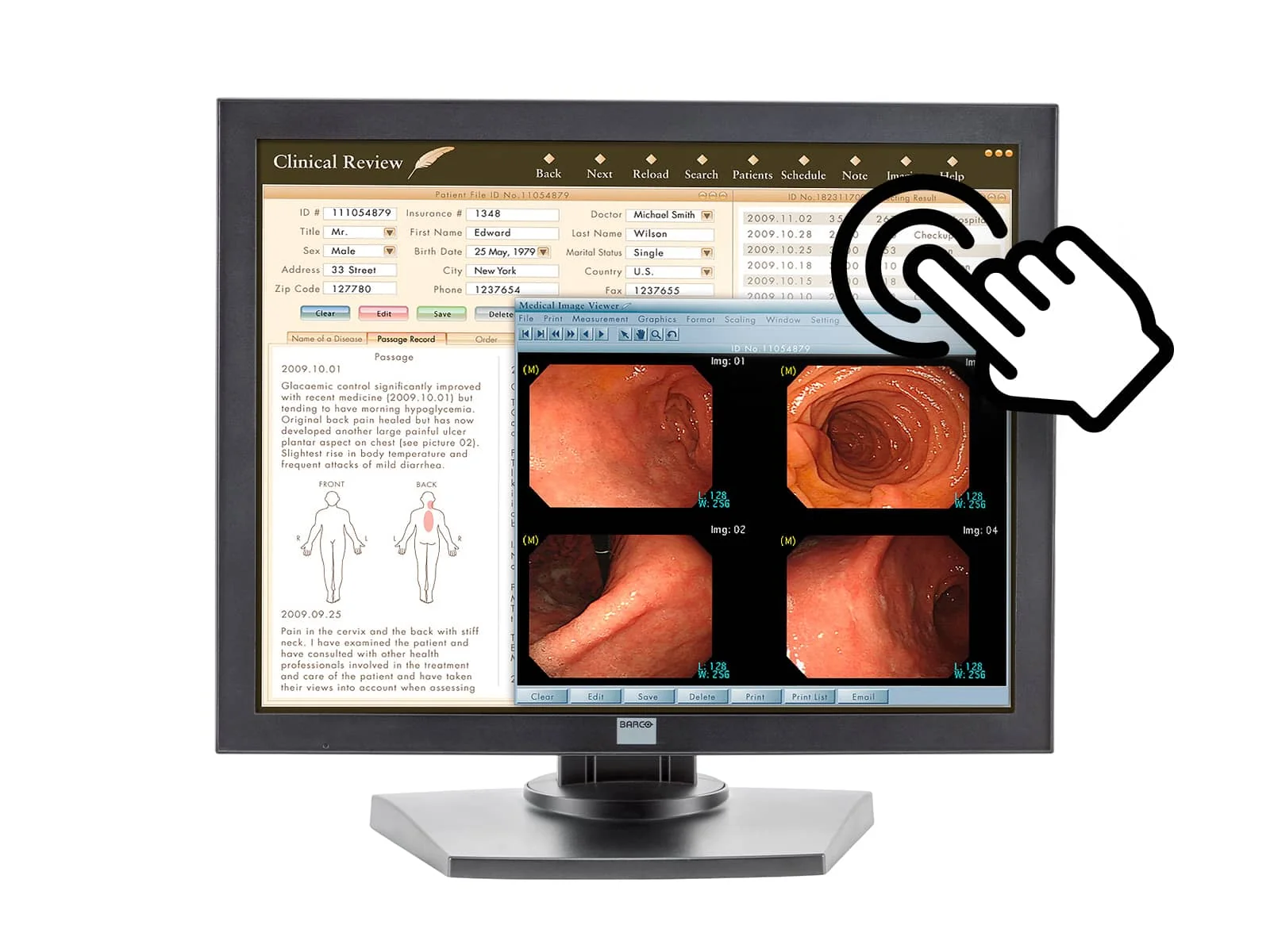 Barco MDRC-1119-TS 1MP 19" Touchscreen Color Clinical Review Display