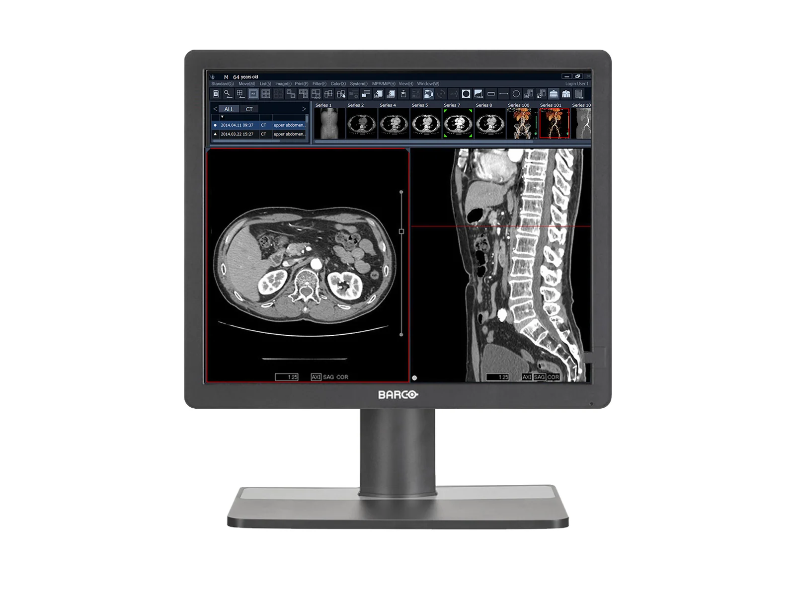 Barco MDRC-1219 1MP 19" Color Clinical Review Display
