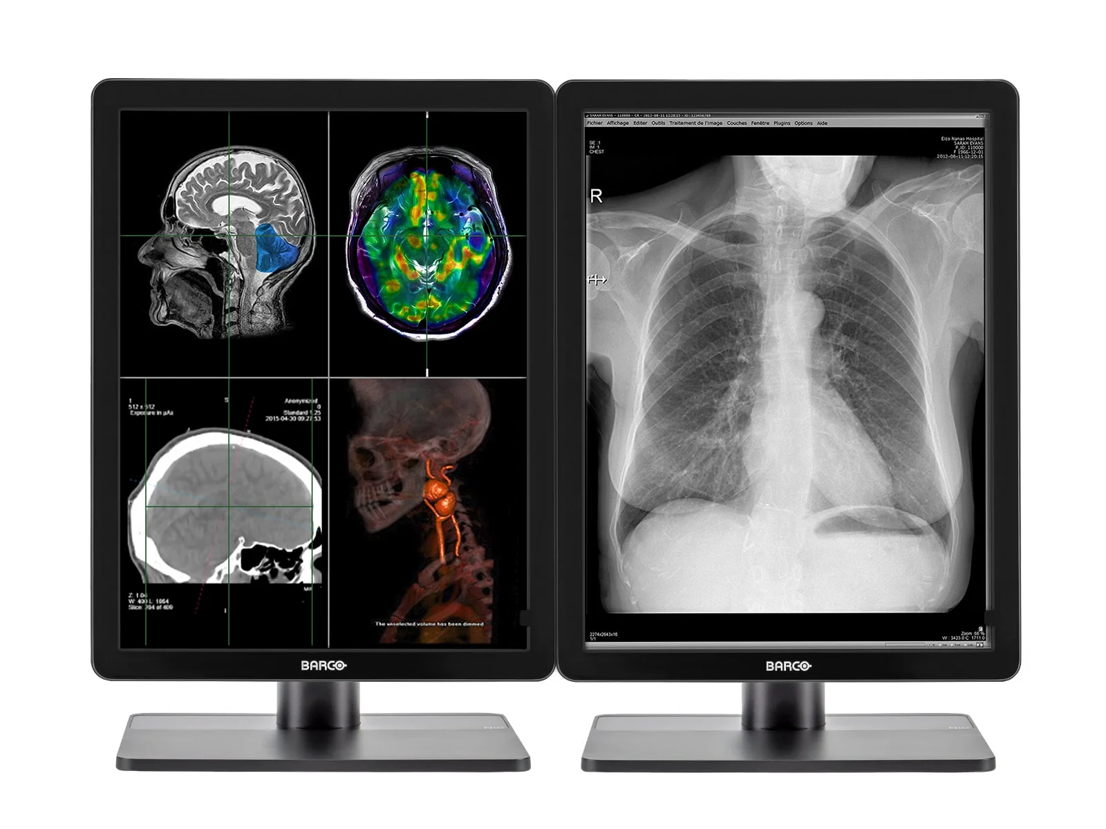 Barco Nio MDNC-2221 2MP 21" Color Diagnostic Radiology Display Monitor