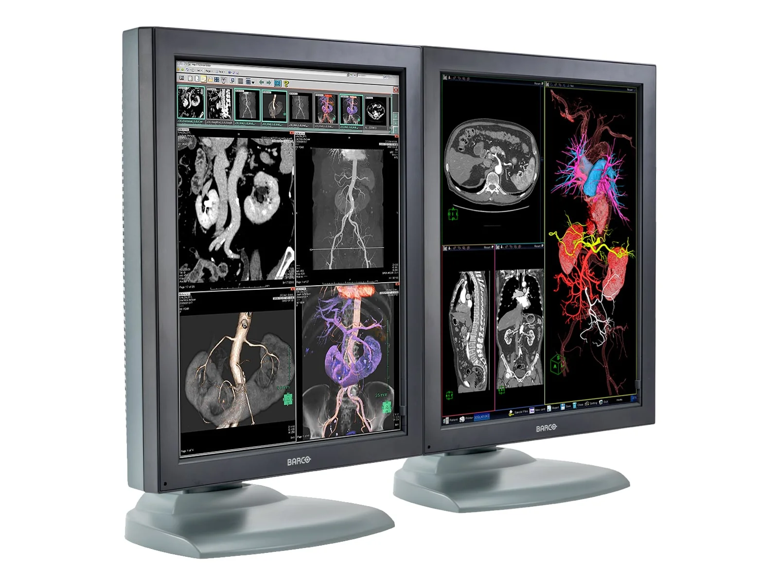 Barco Nio MDNC-3121 HighBright 3MP 21" Color Medical Diagnostic Radiology Monitor - Image 2