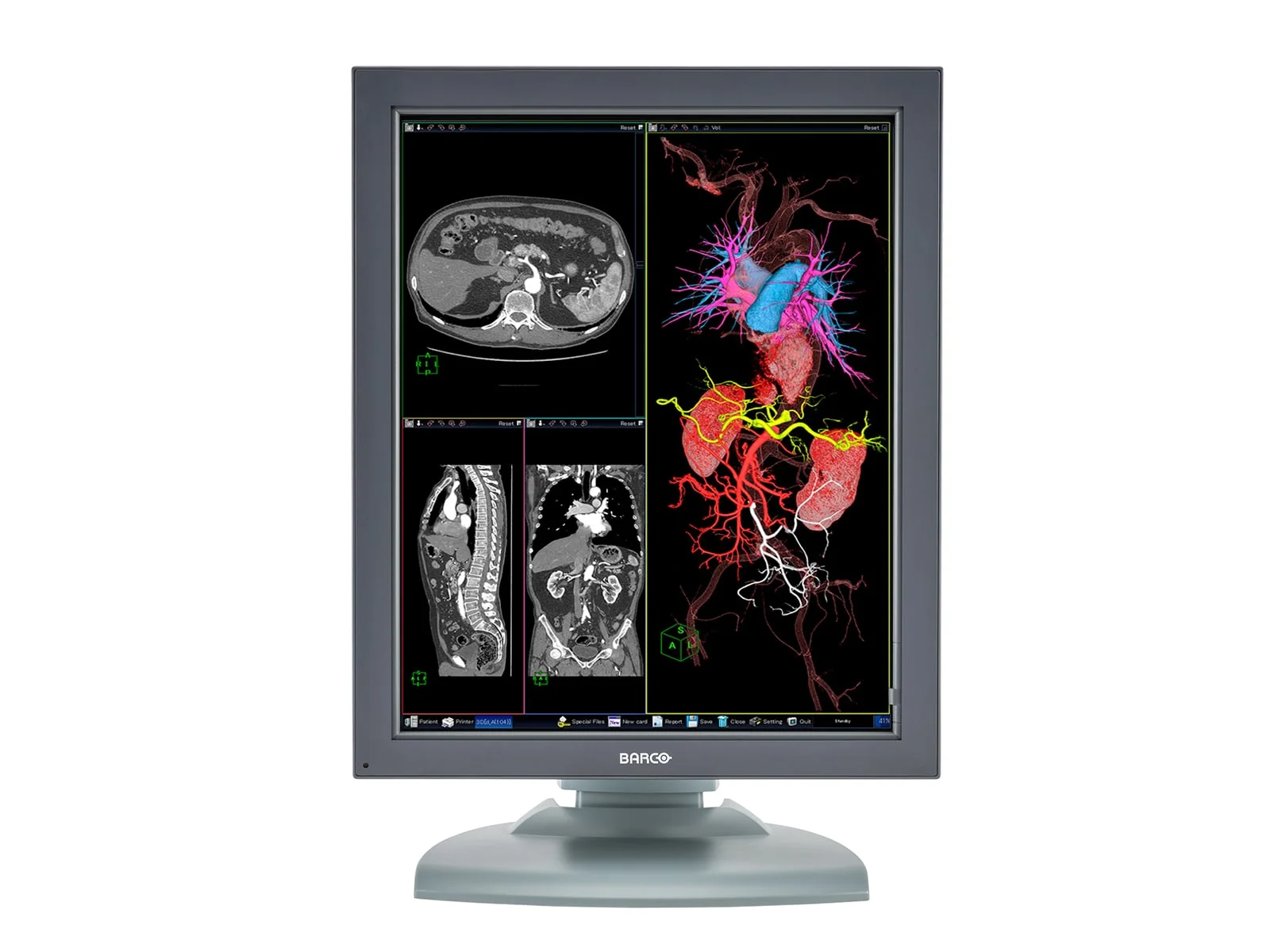 Barco Nio MDNC-3121 HighBright 3MP 21" Color Medical Diagnostic Radiology Monitor - Image 3