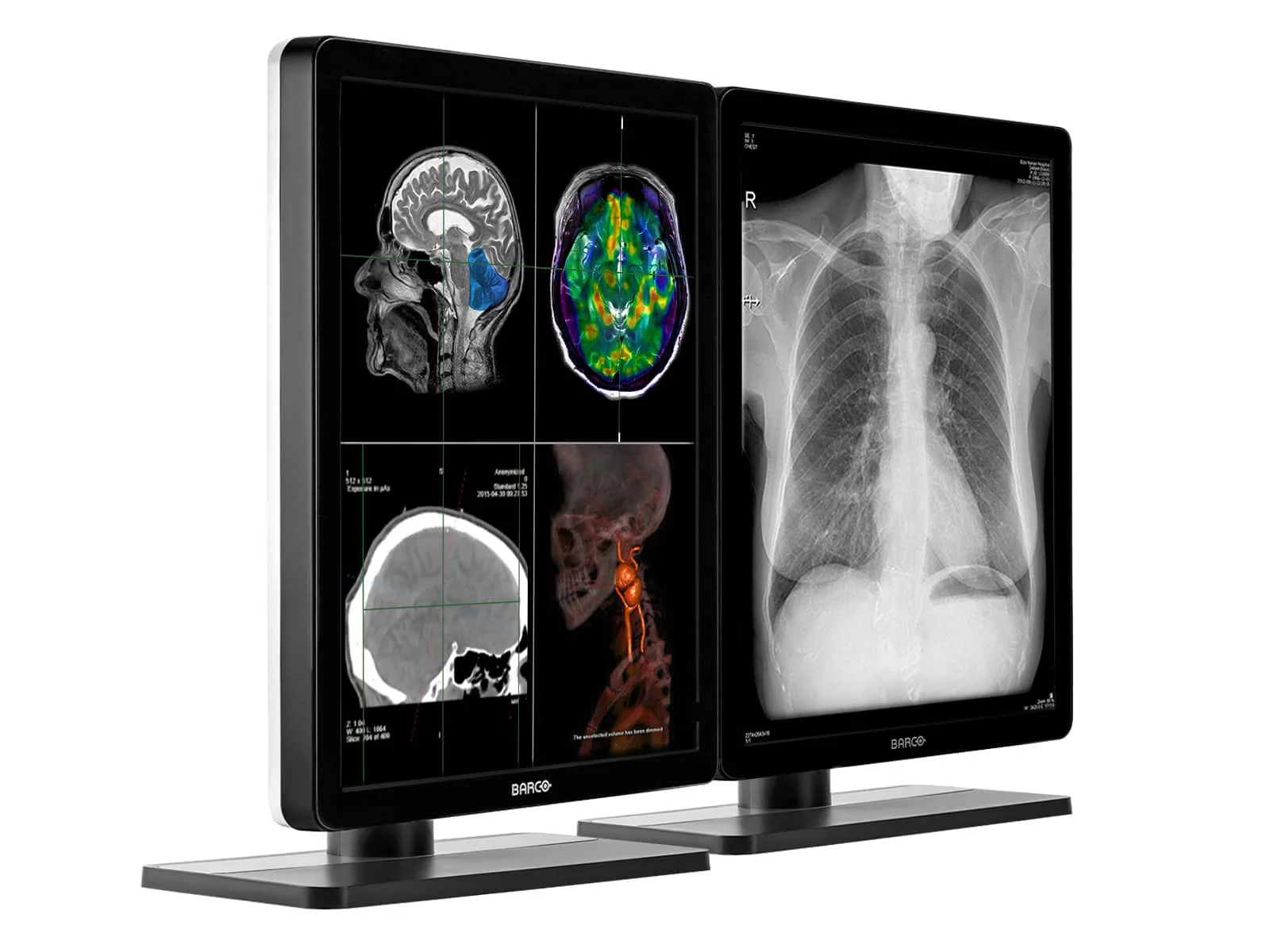 Barco Nio MDNC-3321 3MP 21" Color General Radiology Diagnostic PACS Display - Image 2