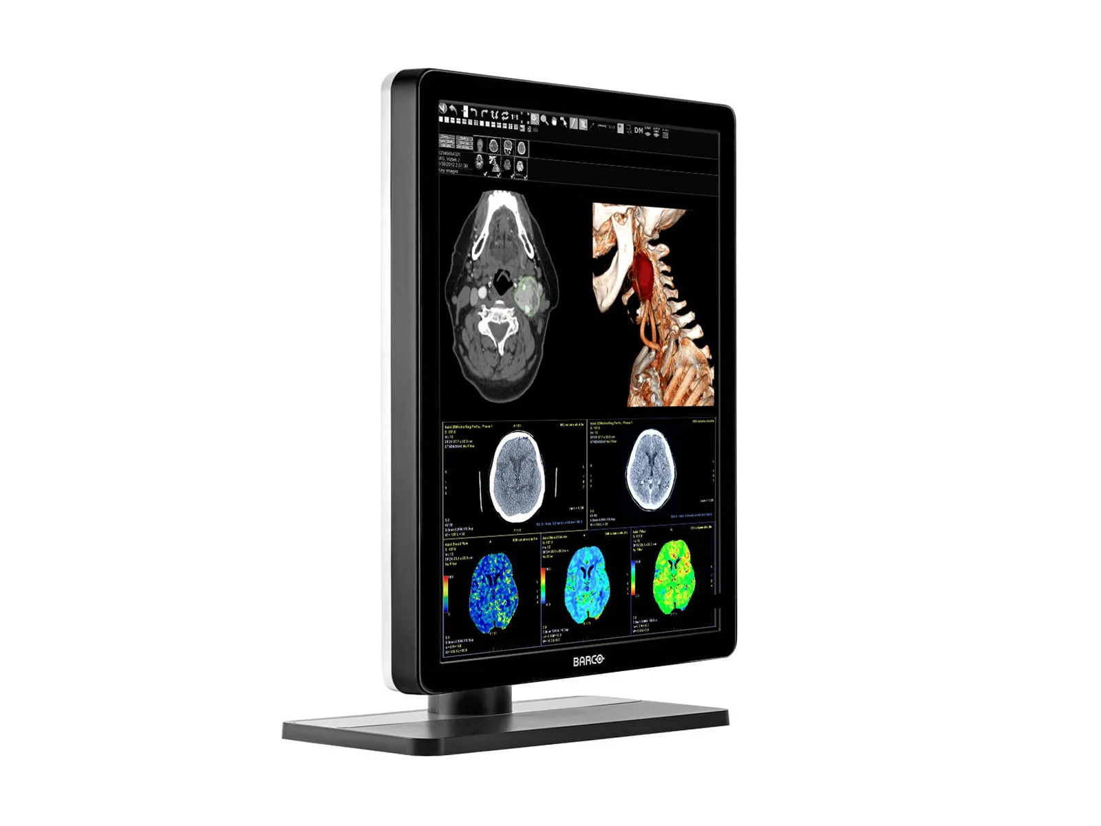 Barco Nio MDNC-3421 3MP 21" Color General Radiology PACS Display - Image 4