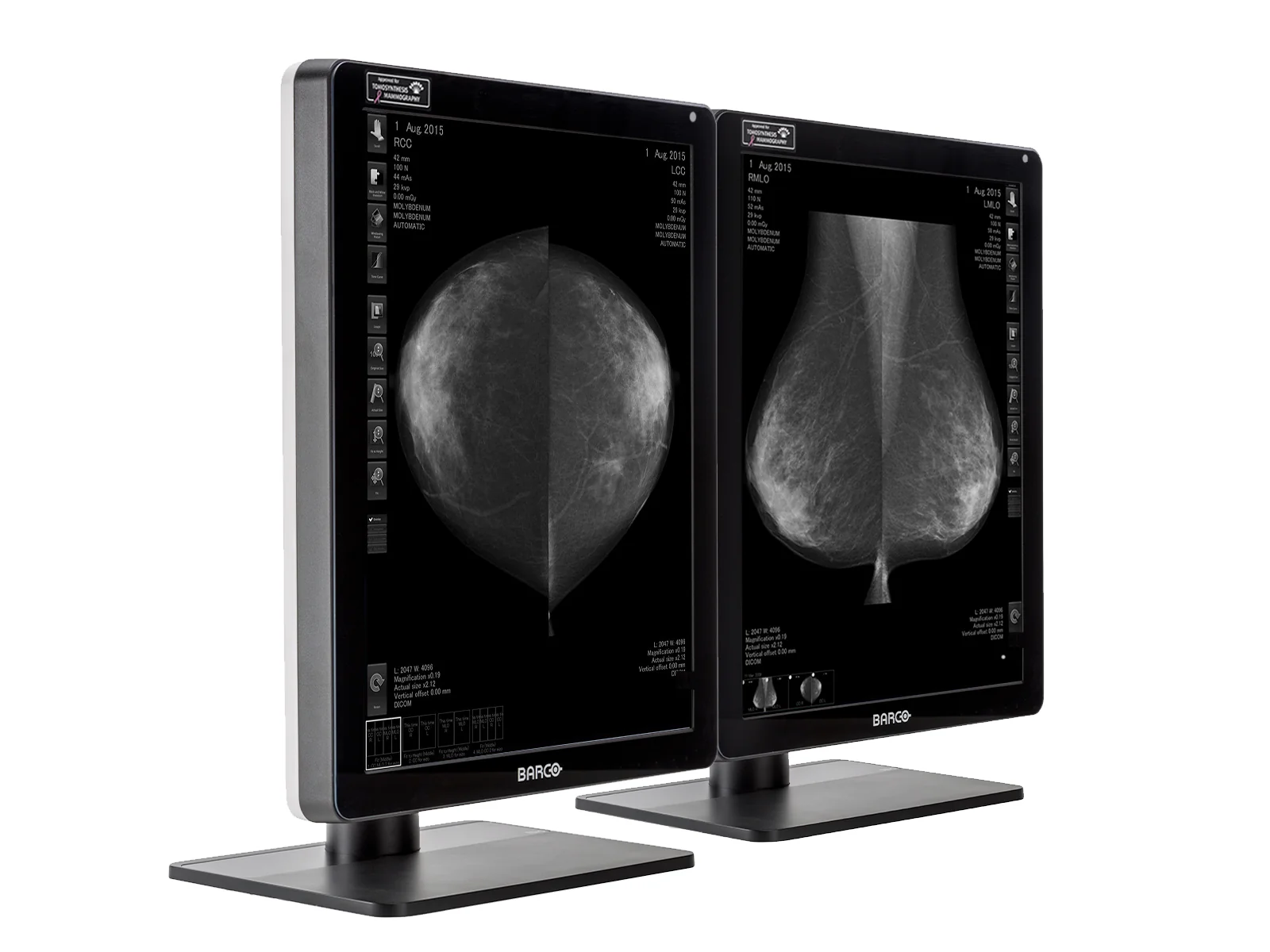 Barco Nio MDNG-6221 5MP 21" Grayscale Mammo 3D-DBT Breast Imaging Display - Image 2