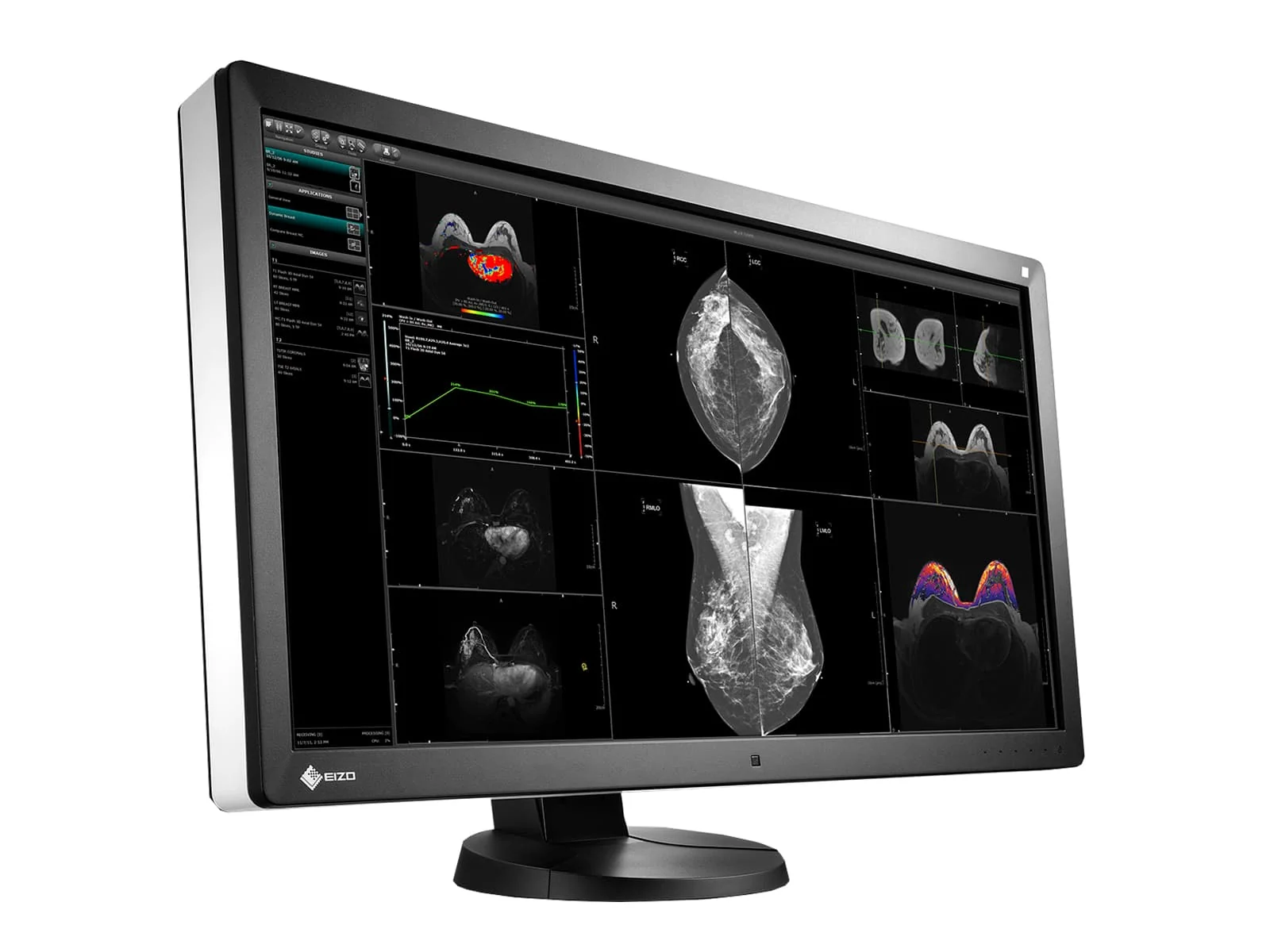 Complete PACS Mammography Reading Station | Eizo Radiforce RX850 8MP Color mammography Monitor | Business Class Workstation | Dictation Mic | Worklist Monitors (RX850P5) - Image 3