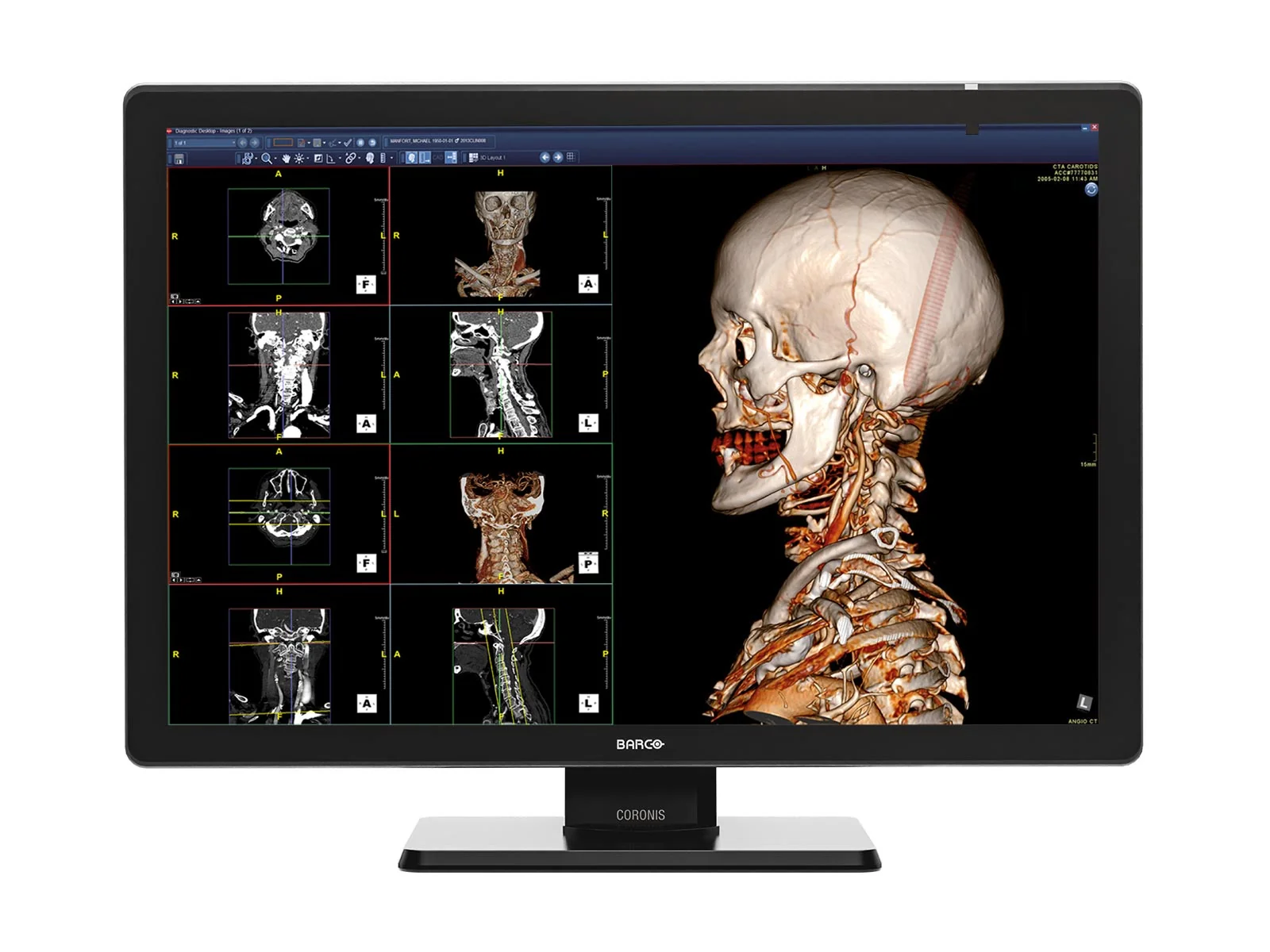 Complete PACS General Radiology Station | Barco Coronis MDCC-6530 6MP Color LED Display | Lenovo Workstation | Dictation Mic | Worklist Monitor (6530Z4R) - Image 2