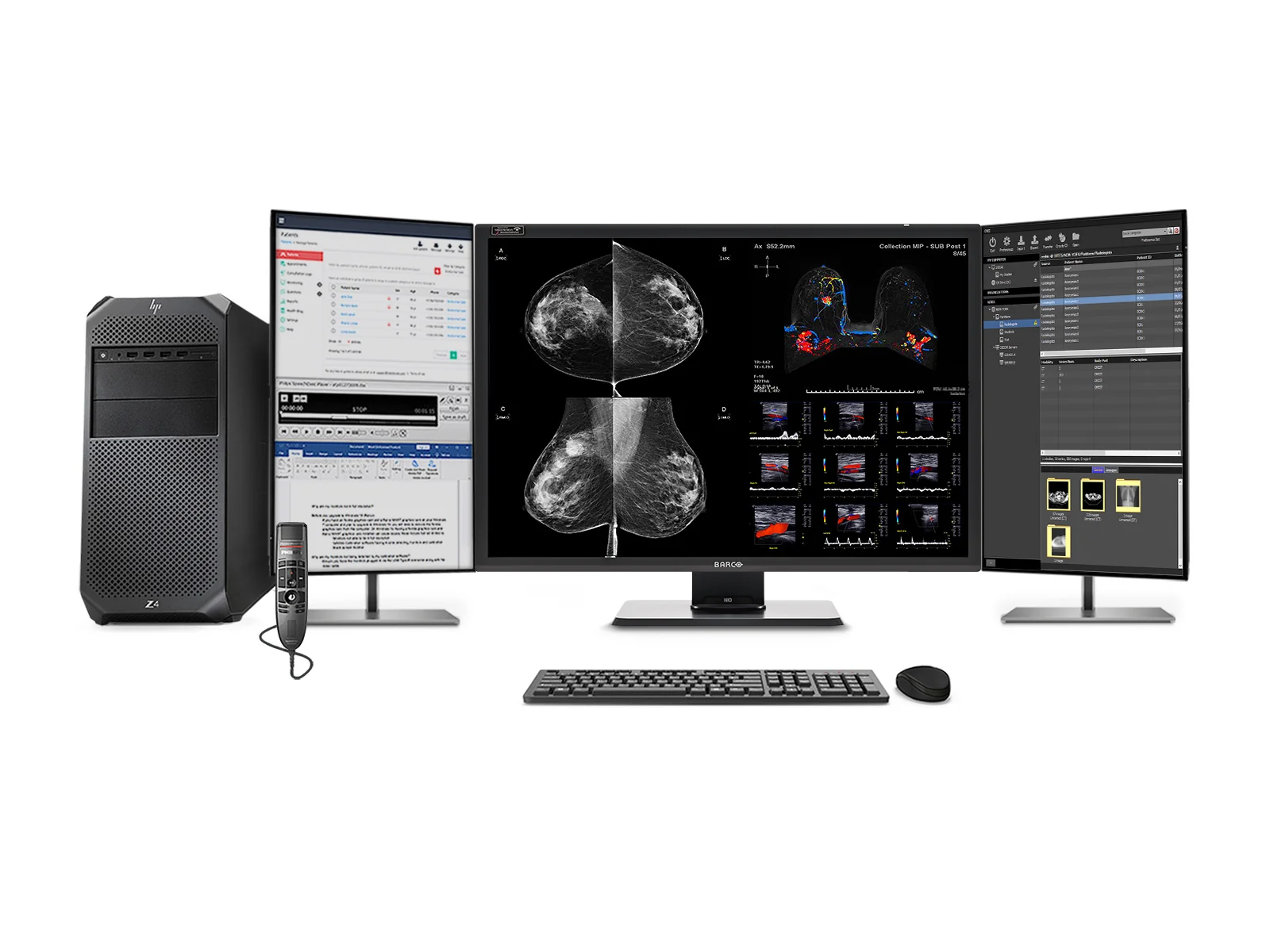 Complete Mammography Reading Station | Barco 12MP MDNC-12130 Color LED Monitors | HP Workstation | Dictation Microphone (LFH3500) | Worklist Monitors (12130Z4G4R)