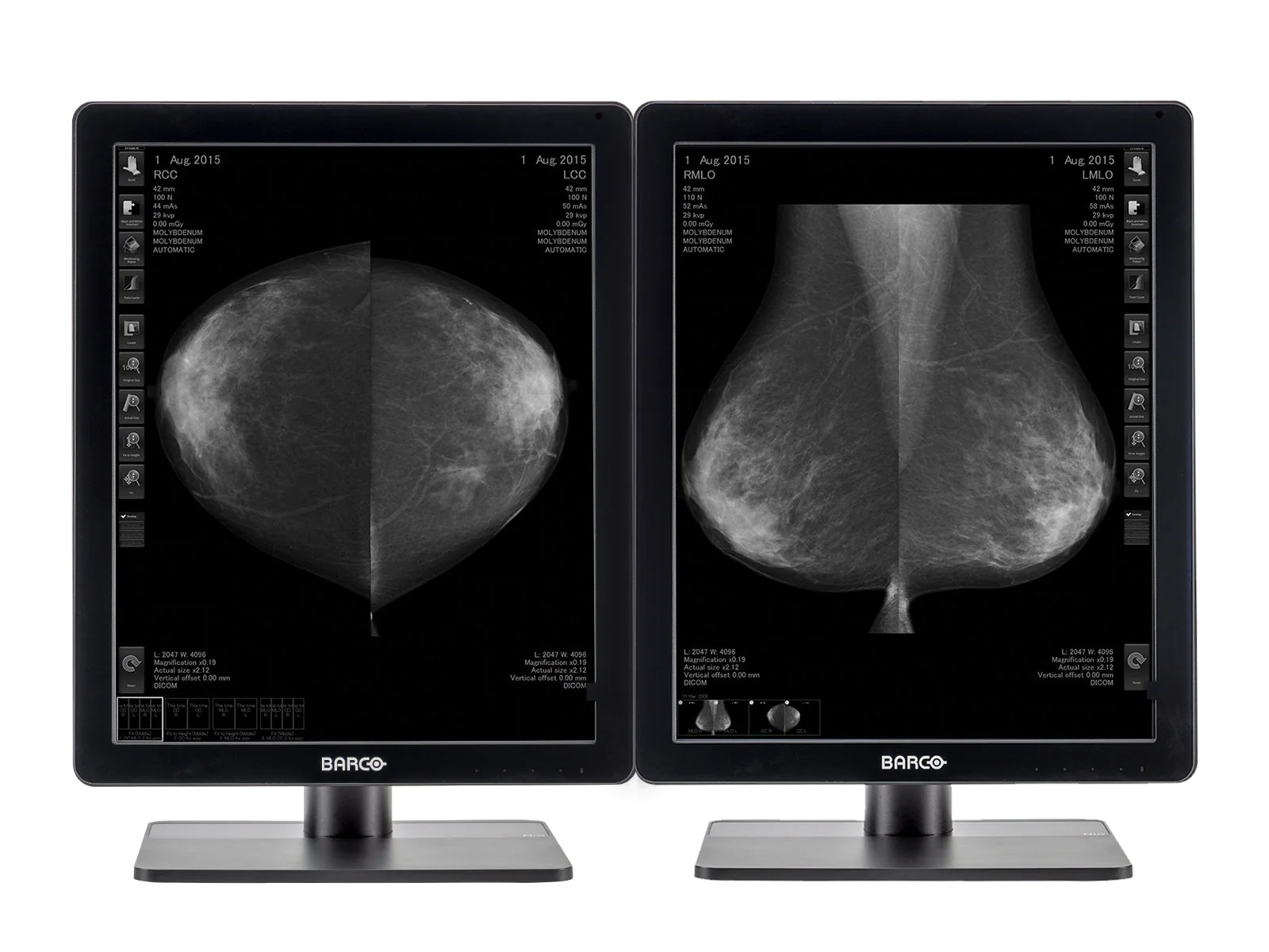 Complete Mammography Reading Station | Barco MDNG-5221 5MP Grayscale LED Monitors | HP Workstation | Dictation Mic | Worklist Monitor (5221Z4R) - Image 2
