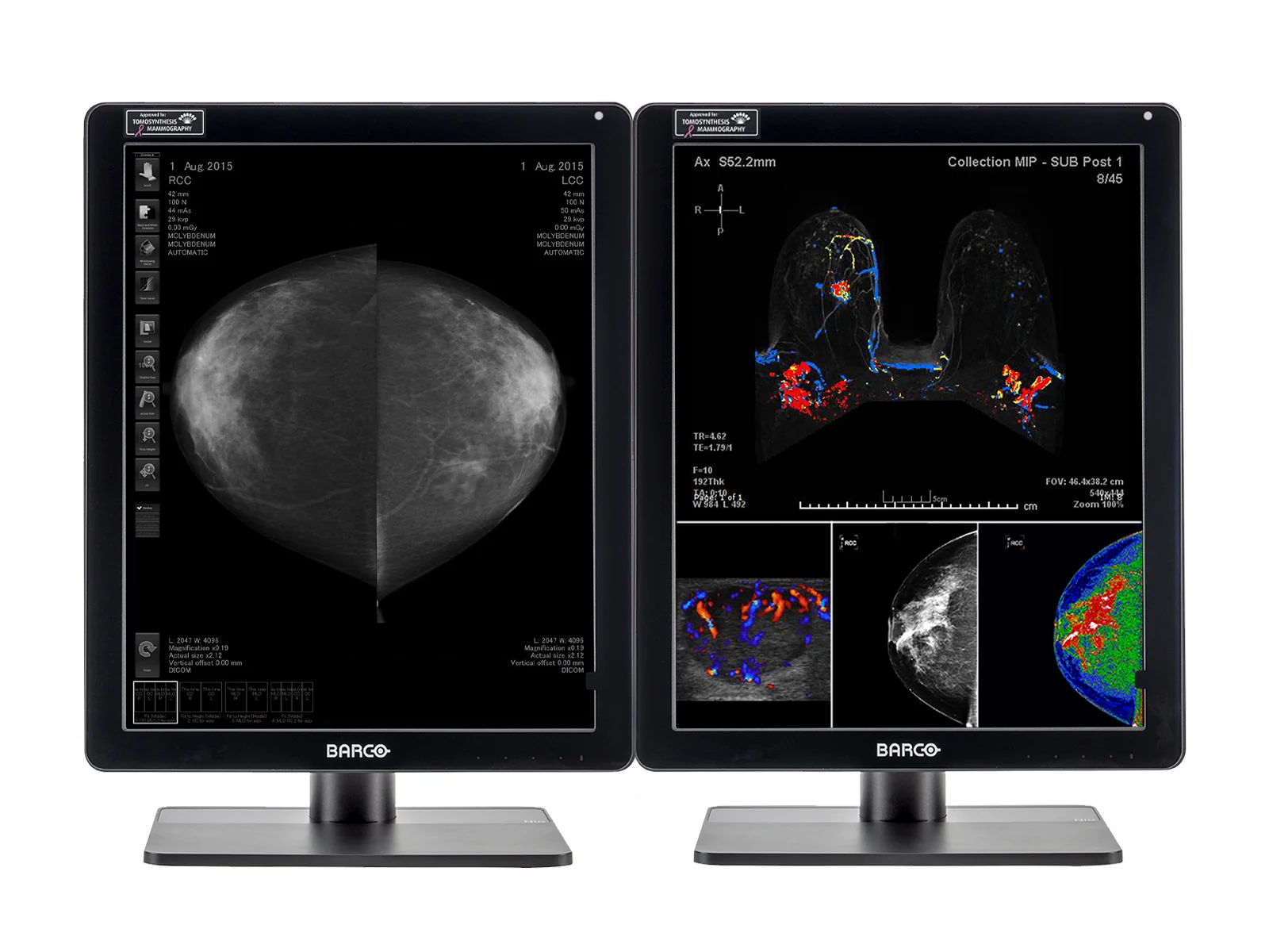 Complete Mammography Reading Station | Barco 5MP MDNC-6121 Color LED Monitors | HP Workstation | Dictation Microphone (LFH3510)| Worklist Monitors (61212321R) - Image 2