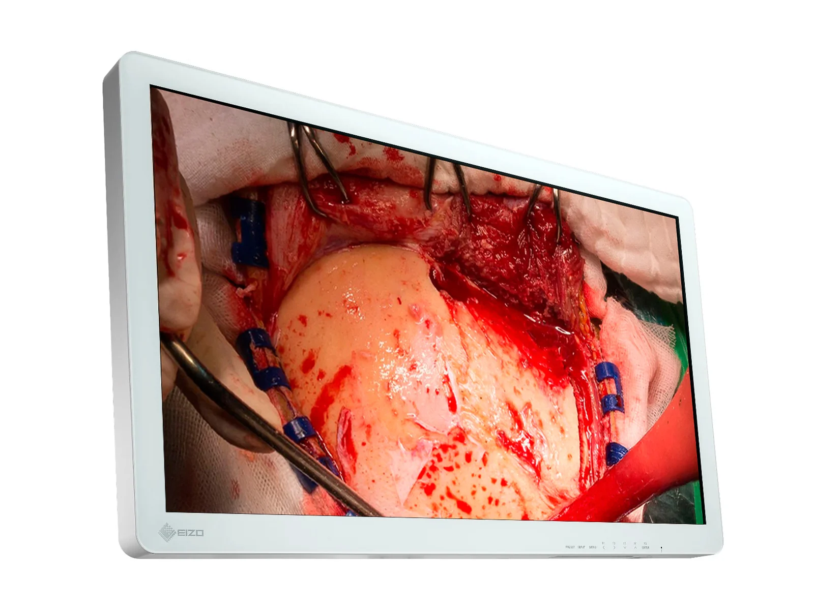 Eizo CuratOR 31.5" FHD Surgical Endoscopy Medical Display Monitor (EX3220) - Image 2