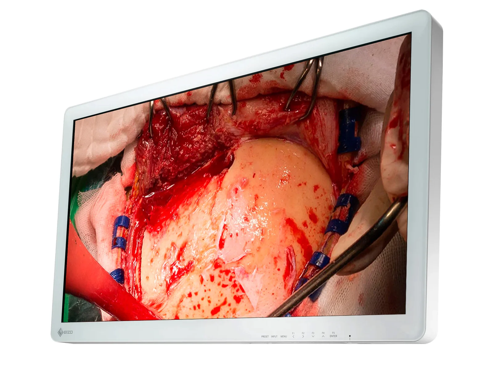 Eizo CuratOR 31.5" FHD Surgical Endoscopy Medical Display Monitor (EX3220) - Image 3