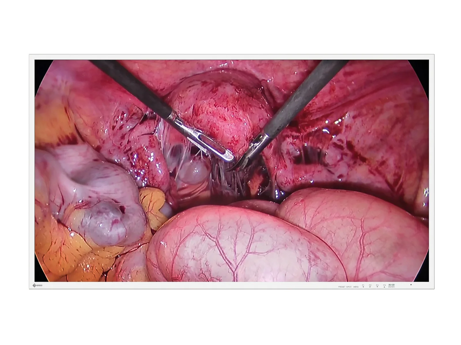 Eizo 43" 4K 3D UHD Surgical Endoscopy Medical Display Monitor (EX4342-3D)
