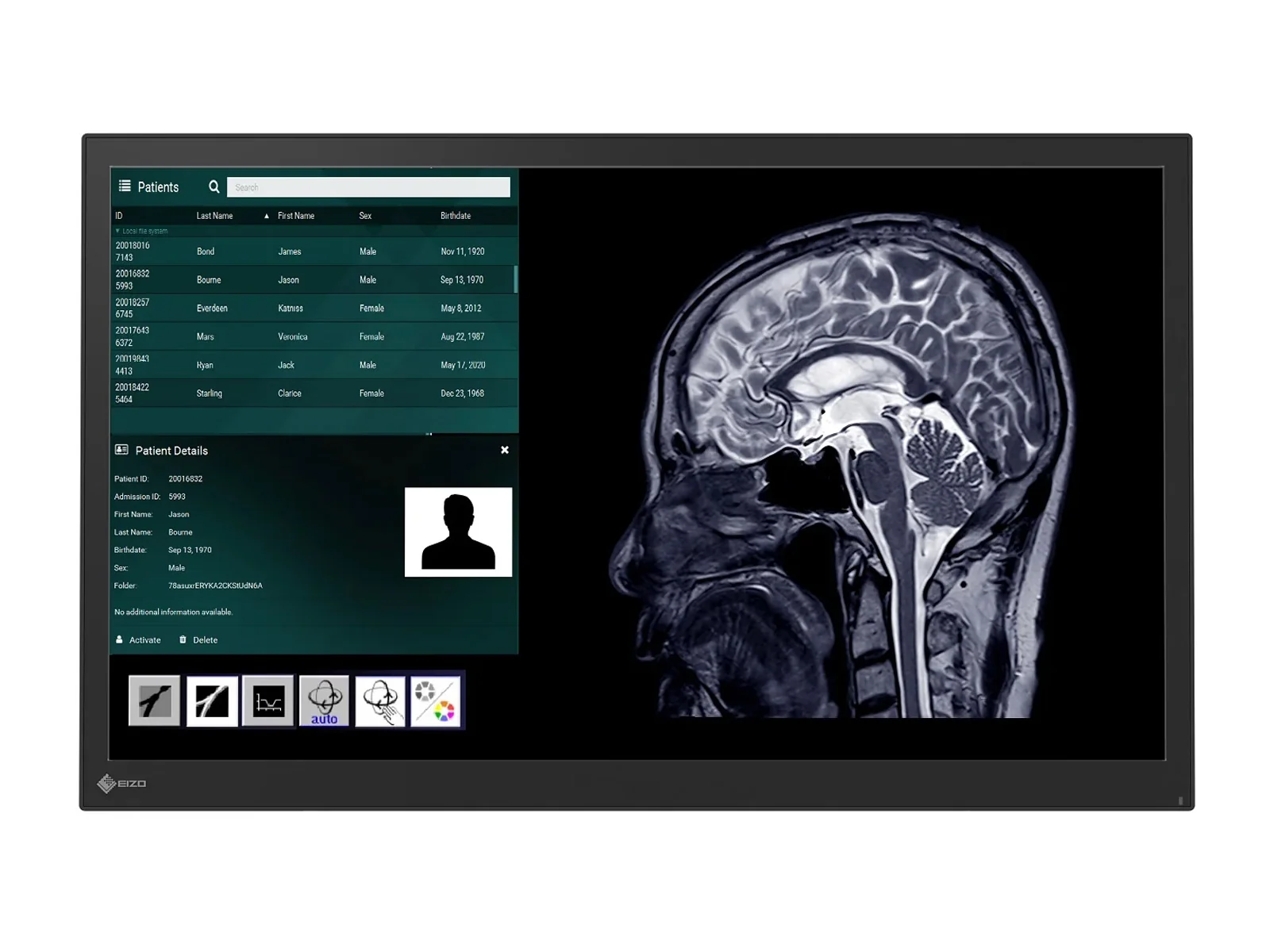 Eizo CuratOR LX2420-T 24" Surgical Touchscreen Monitor (LX2420-T) - Image 4
