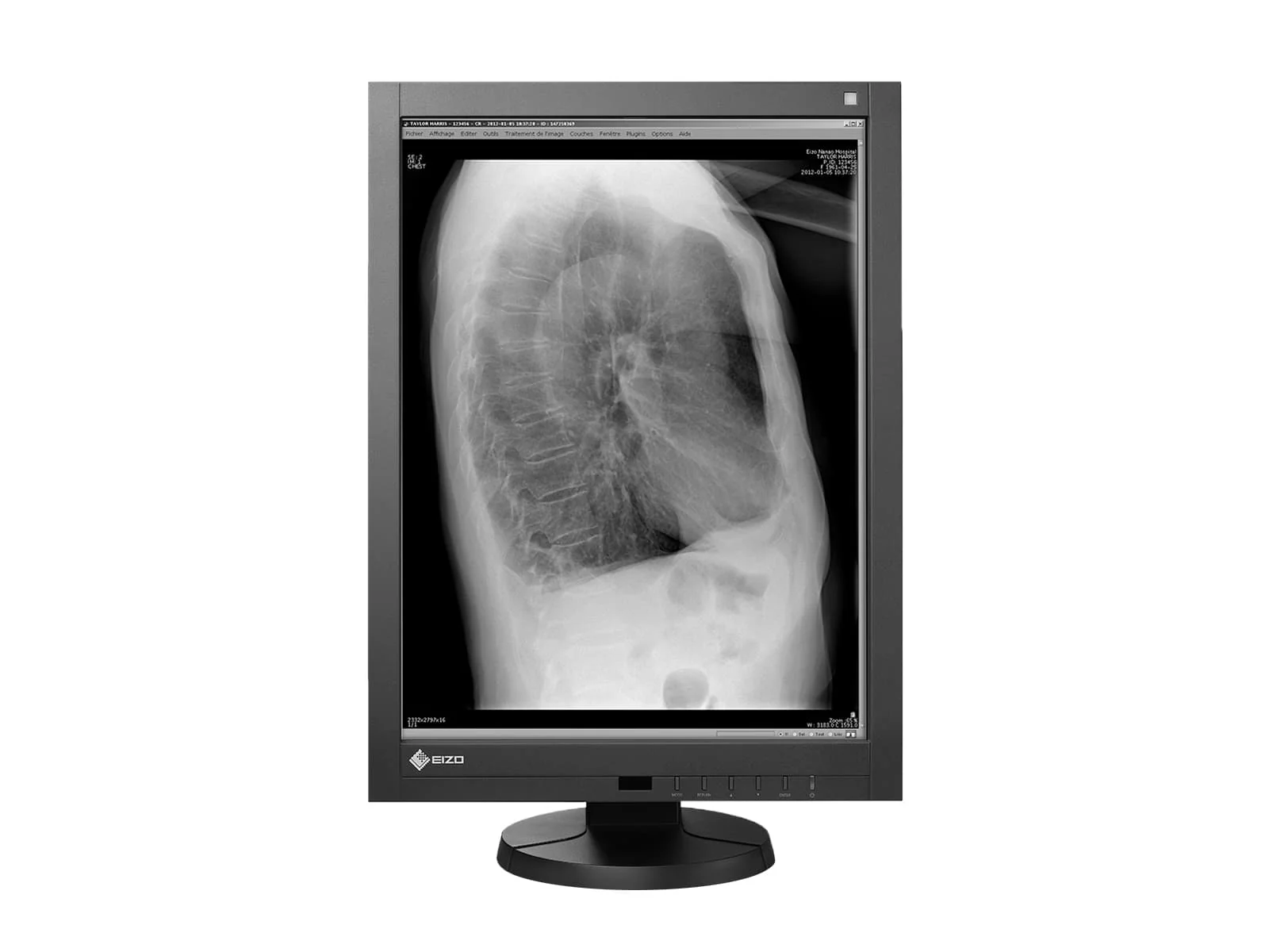 Eizo RadiForce GX340 3MP 21" Grayscale General Radiology Diagnostic Display Monitor (GX340-CL) - Image 3
