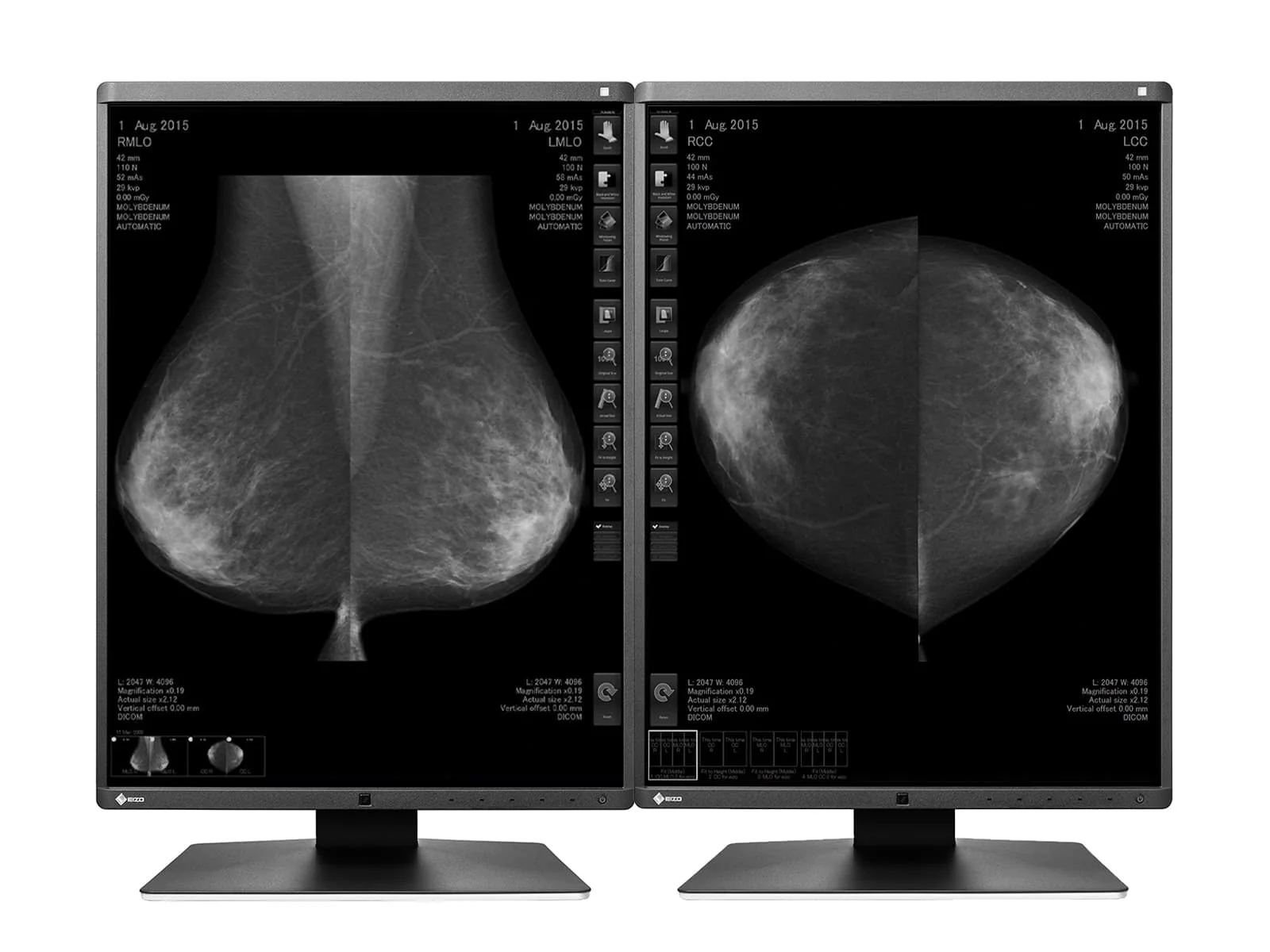 Eizo RadiForce GX550 5MP 21" Grayscale Mammo 3D-DBT Breast Imaging Display (GX550-BK)