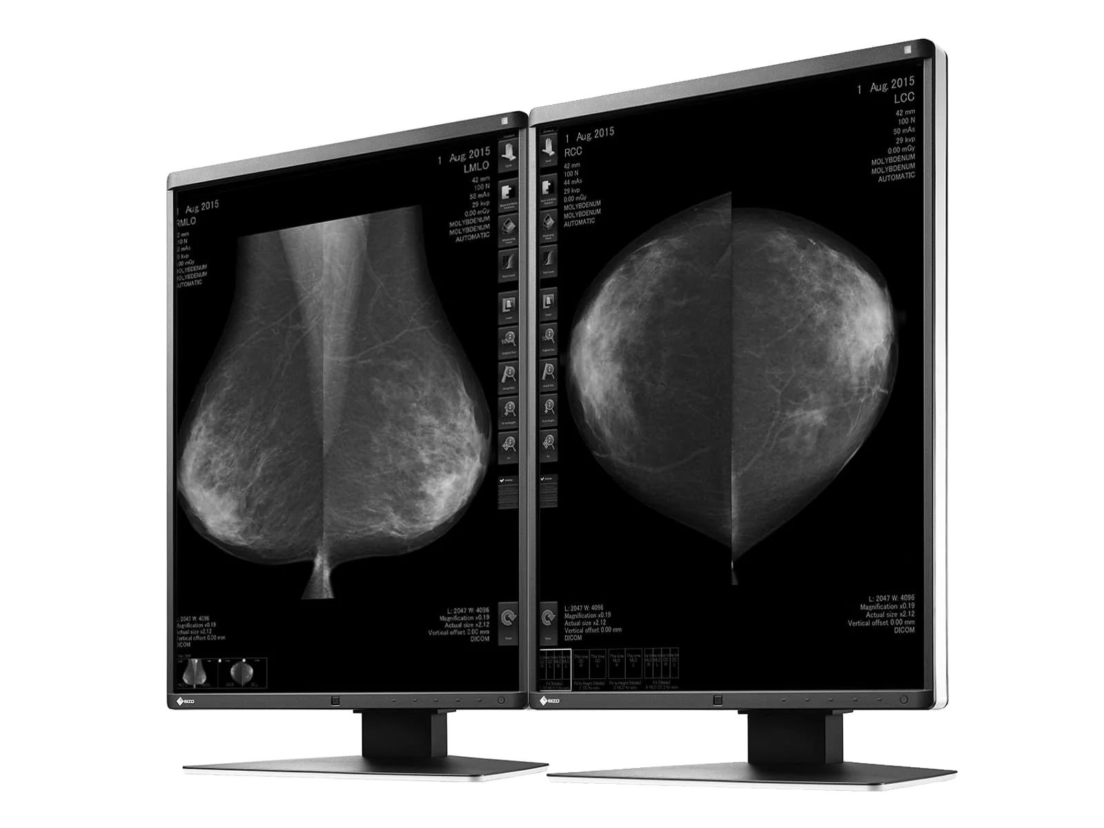 Eizo RadiForce GX550 5MP 21" Grayscale Mammo 3D-DBT Breast Imaging Display (GX550-BK) - Image 2
