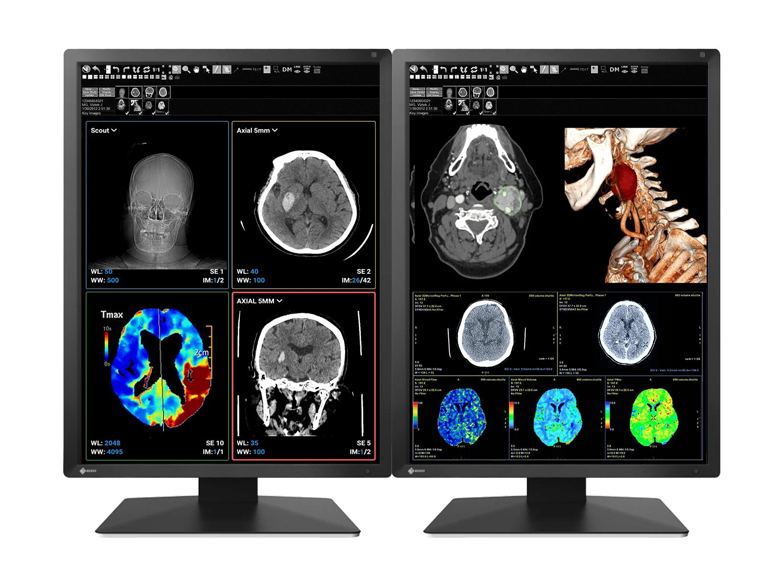 Eizo RadiForce MX217 2MP 21" Color Medical Display Monitor (MX217-BK)
