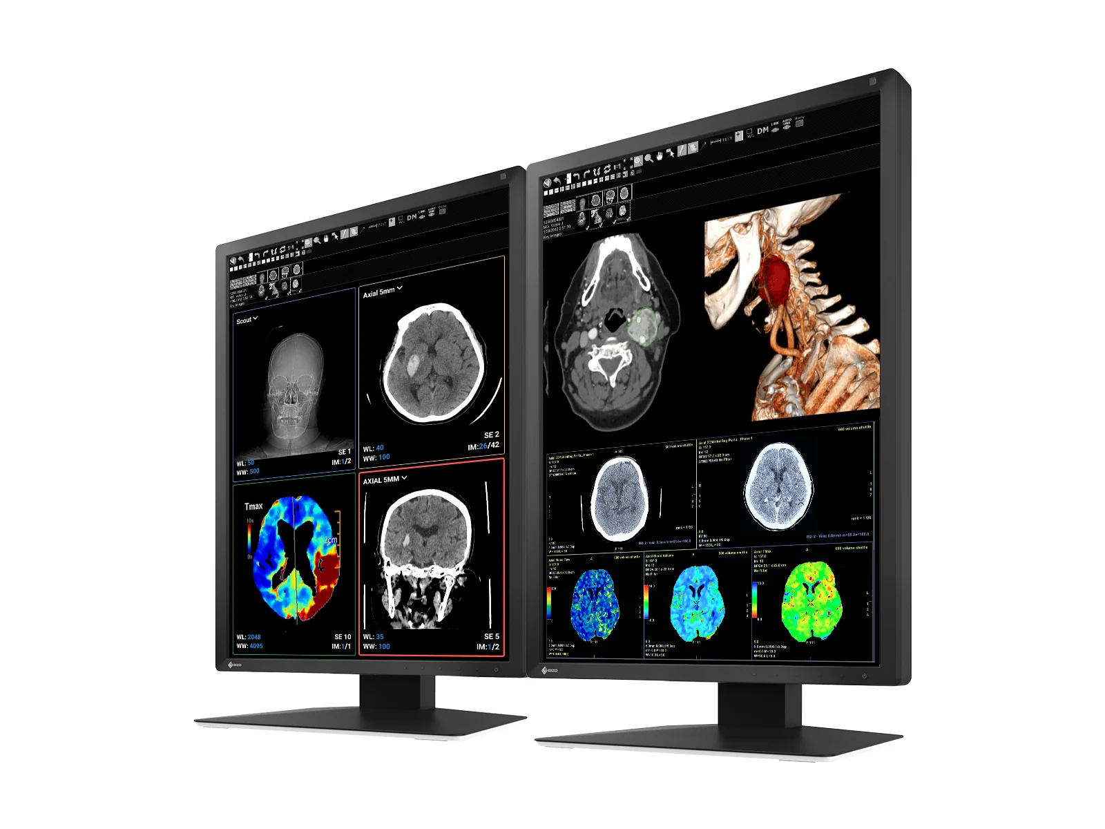 Eizo RadiForce MX217 2MP 21" Color Medical Display Monitor (MX217-BK) - Image 2