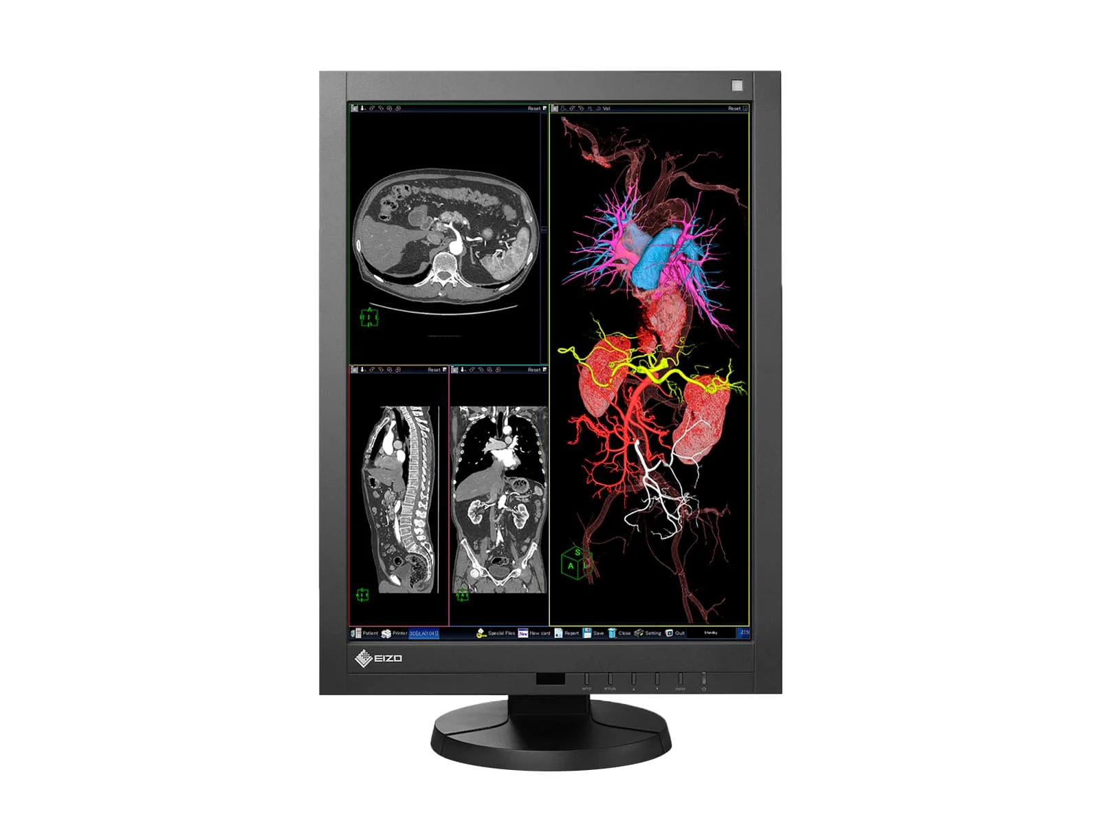 Eizo Radiforce RX240 2MP 21" Color General Radiology Diagnostic PACS Display (RX240) - Image 3