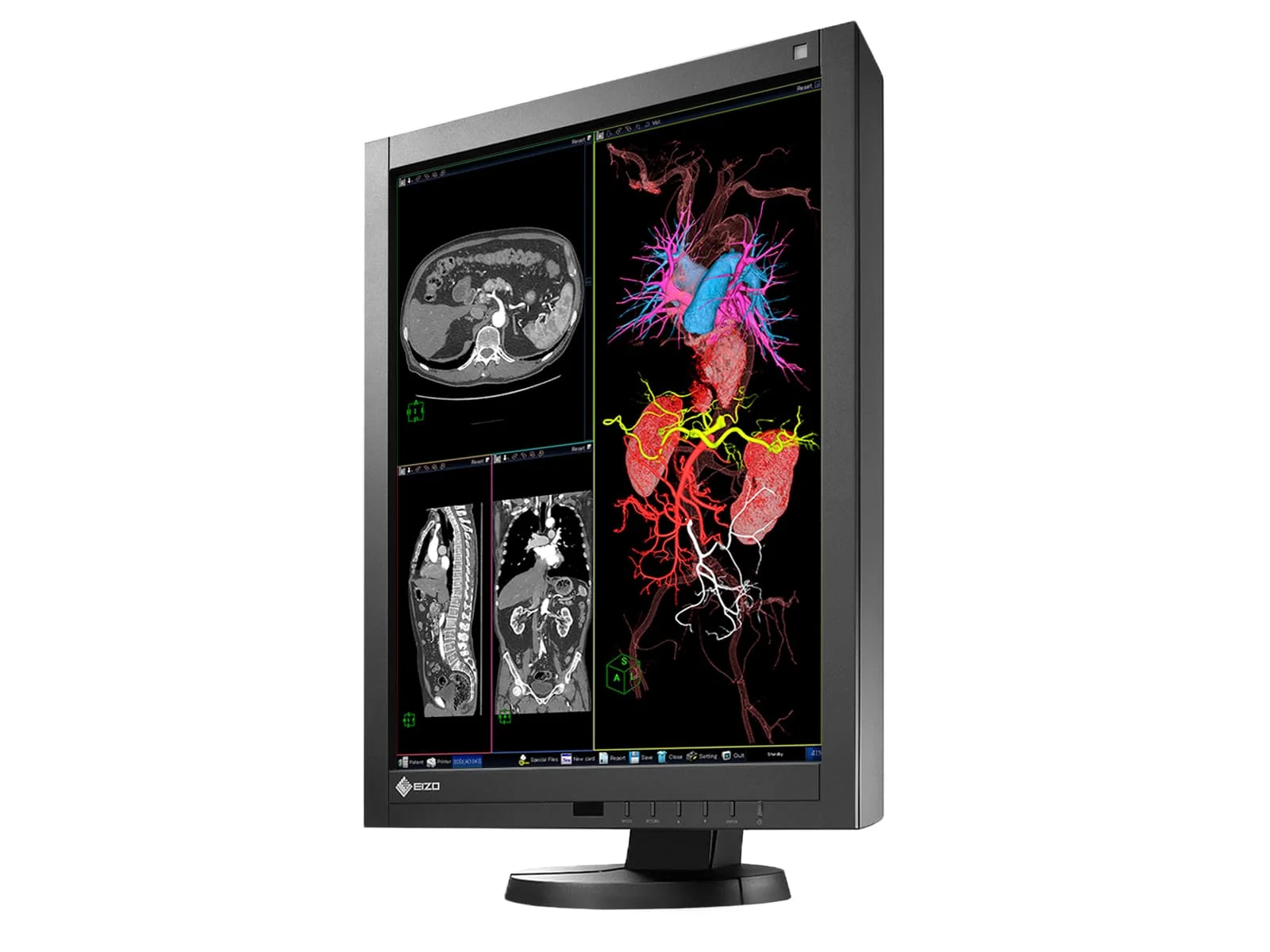 Eizo Radiforce RX240 2MP 21" Color General Radiology Diagnostic PACS Display (RX240) - Image 4
