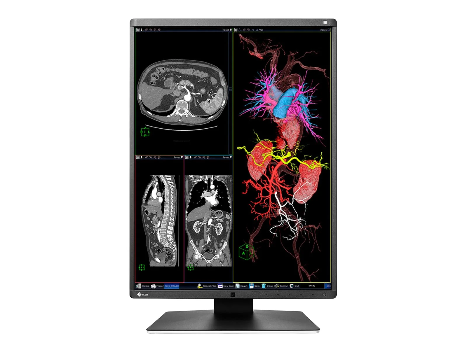 Eizo RadiForce RX360 3MP 21" Color General Radiology PACS Display Monitor (RX360) - Image 4