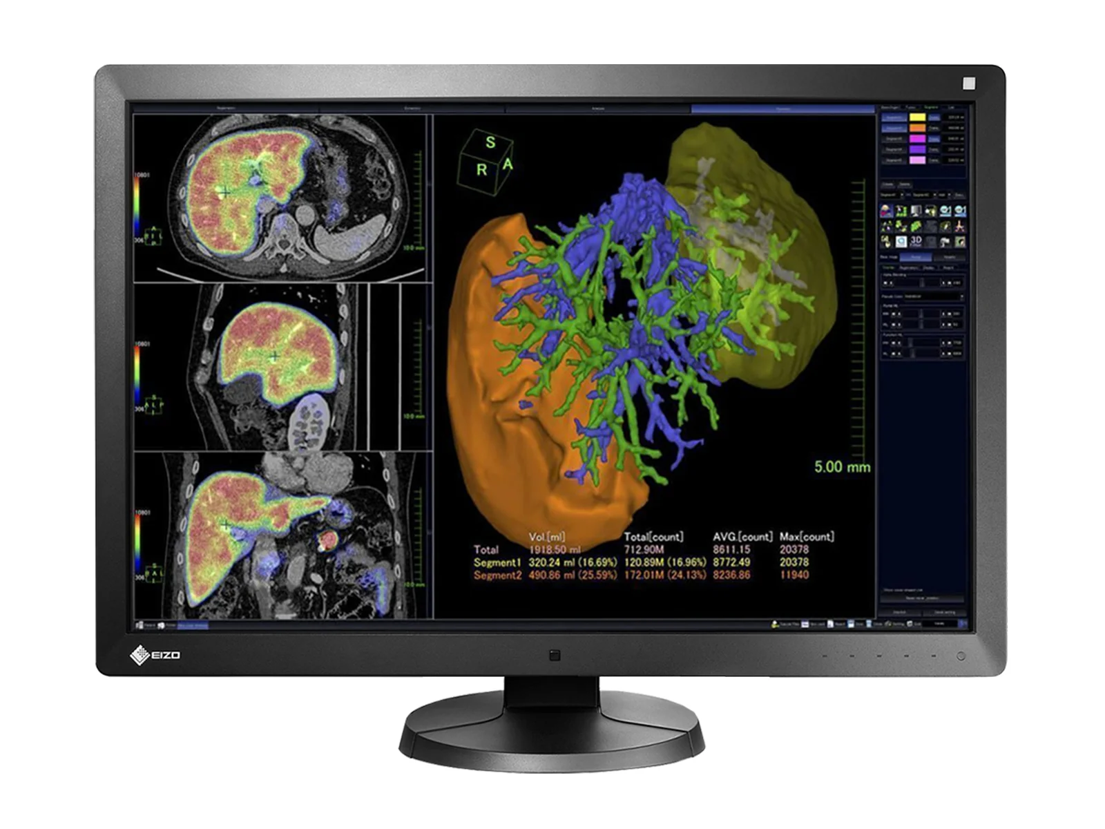 Eizo RadiForce RX650 6MP 30" Color General Radiology PACS Display (RX650)
