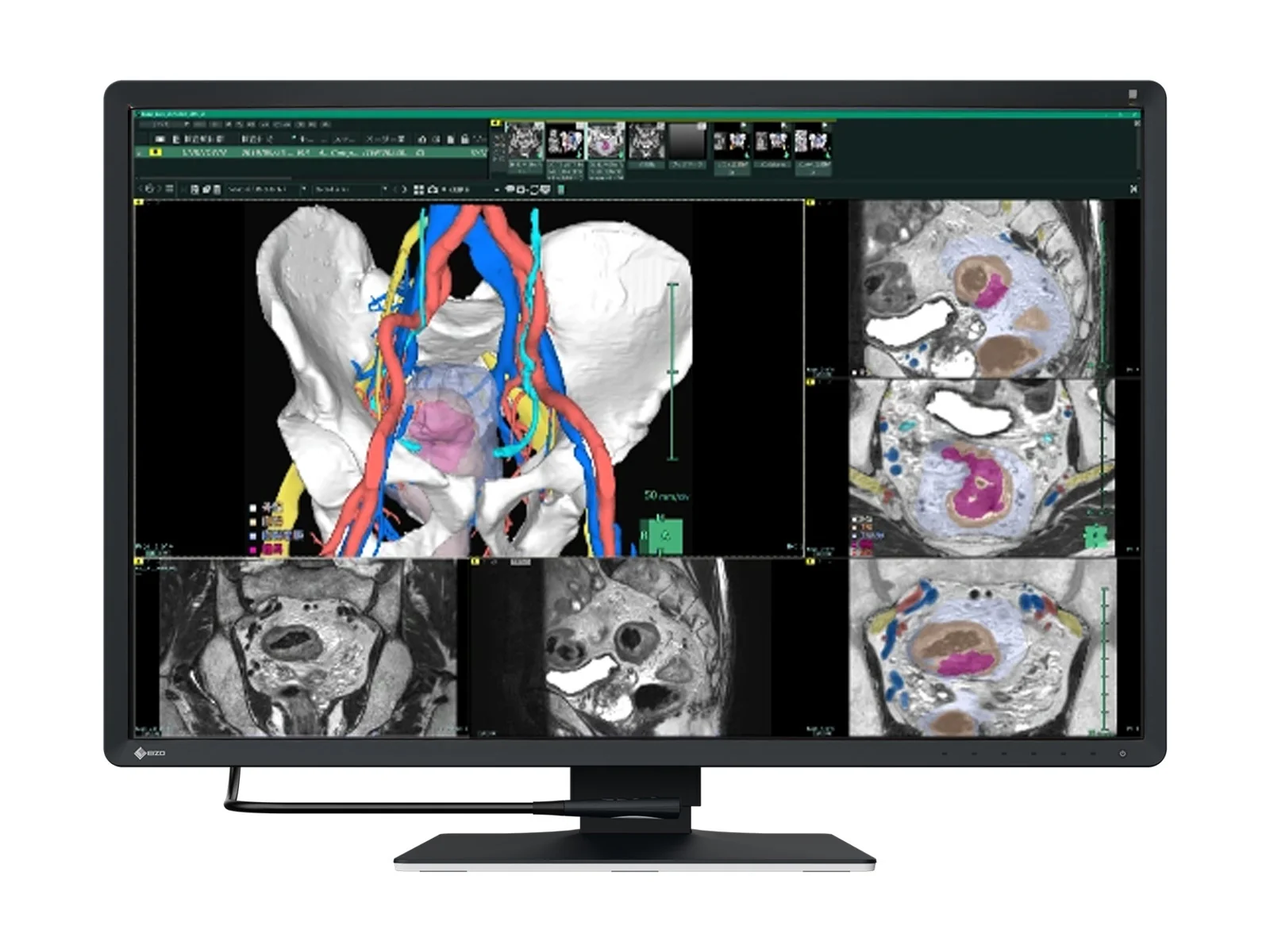Eizo RadiForce RX670 6MP 30" Color General Radiology PACS Display (RX670)