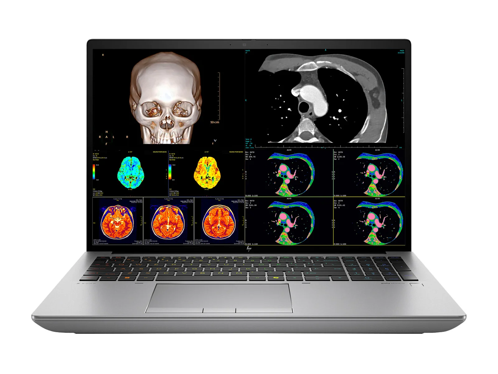 HP ZBook Fury 16 G11 Mobile Radiology Workstation | 16" OLED 9MP 4K+ UHD DICOM Calibrated | Core i9-14900HX @ 5.8GHz | 24-Core | 32GB DDR5 | 512GB NVMe SSD | RTX 2000 Ada 8GB | WiFi 6E
