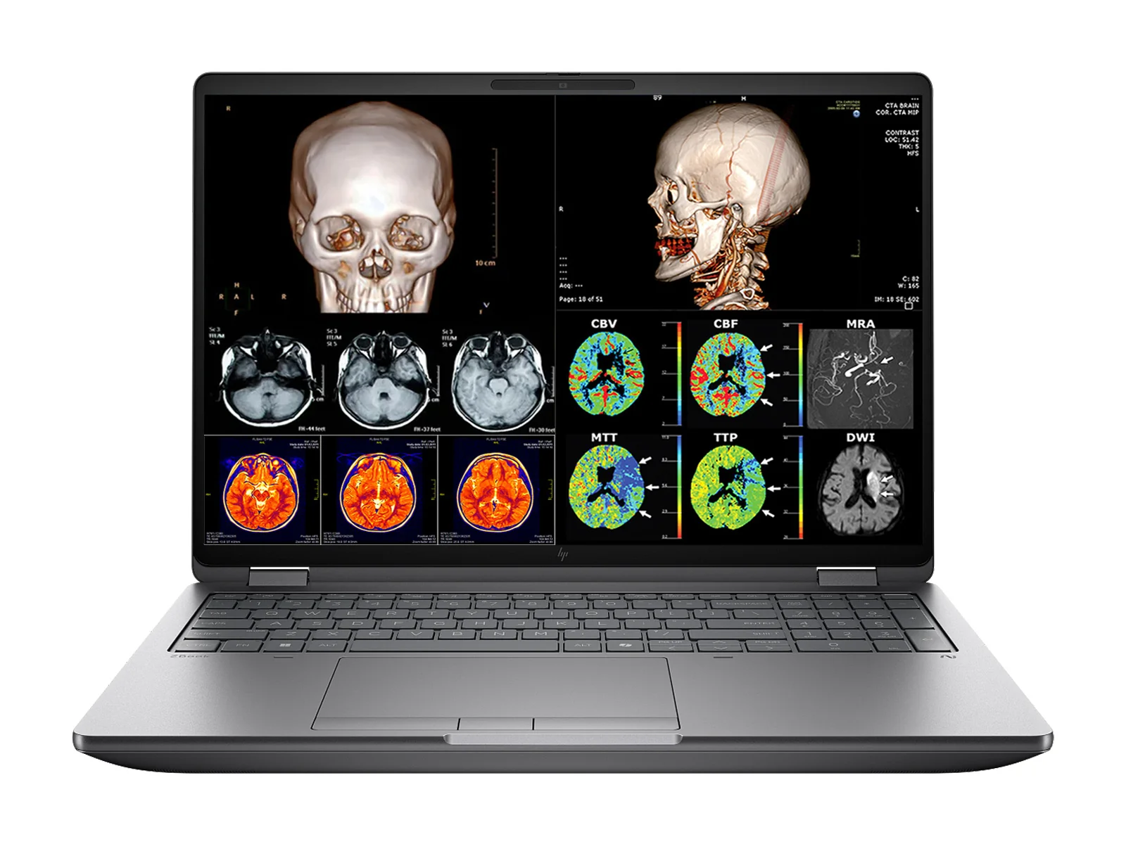 HP ZBook Fury G1i 16 Mobile Workstation | 16" DICOM Calibrated 9MP OLED 4K+ UHD WQUXGA (3840 x 2400) Display | Intel Core Ultra 9 285HX @ 5.5GHz MT | 24-Core | 64GB DDR5 | 512GB NVMe SSD | Intel UHD Graphics | WiFi 7 | PerfectLUM License