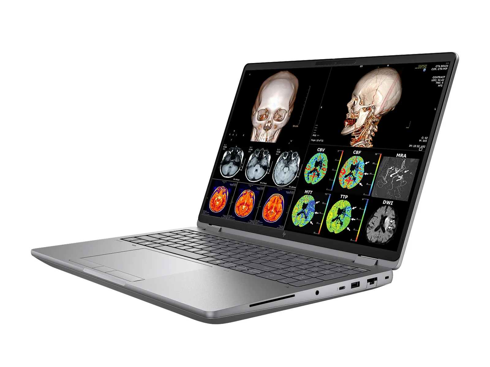 HP ZBook Fury G1i 16 Mobile Workstation | 16" DICOM Calibrated 9MP OLED 4K+ UHD WQUXGA (3840 x 2400) Display | Intel Core Ultra 9 285HX @ 5.5GHz MT | 24-Core | 64GB DDR5 | 512GB NVMe SSD | Intel UHD Graphics | WiFi 7 | PerfectLUM License - Image 3