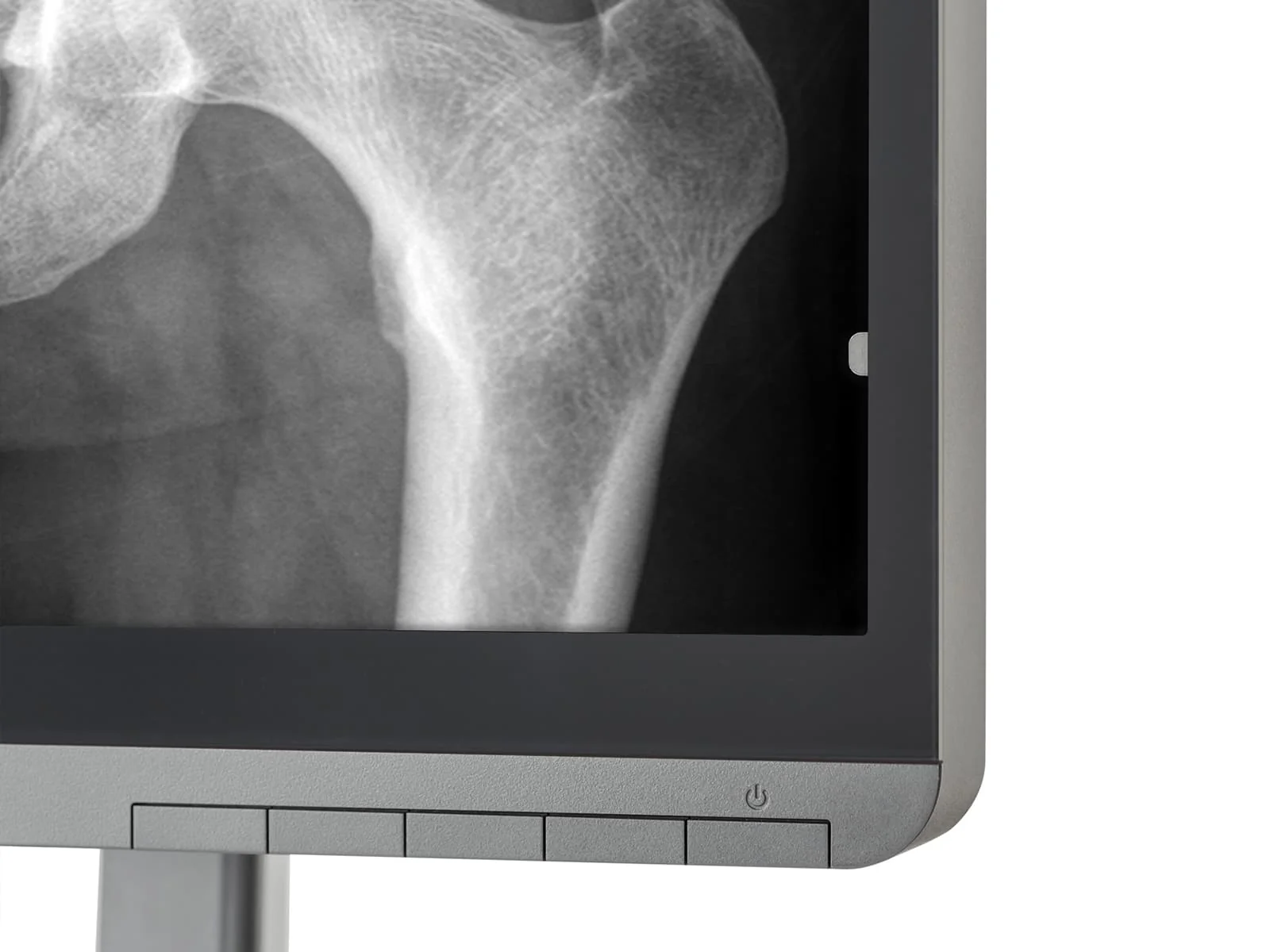 JVC Totoku CL-S200 2MP 21" Color PACS Display Monitor (CL-S200) - Image 8