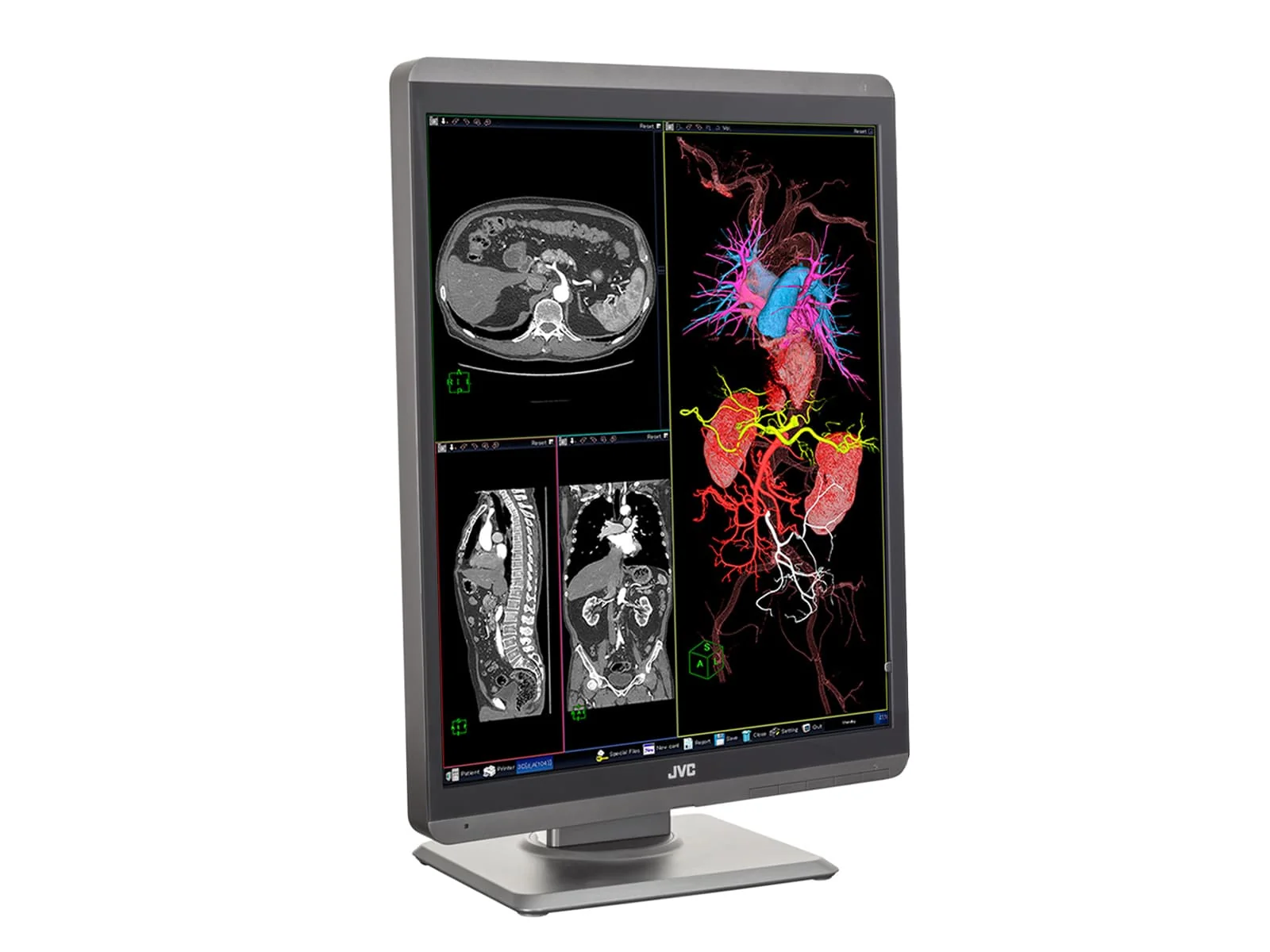 JVC Totoku CL-S300 3MP 21" Color General Radiology Diagnostic Display Monitors (CL-S300) - Image 5
