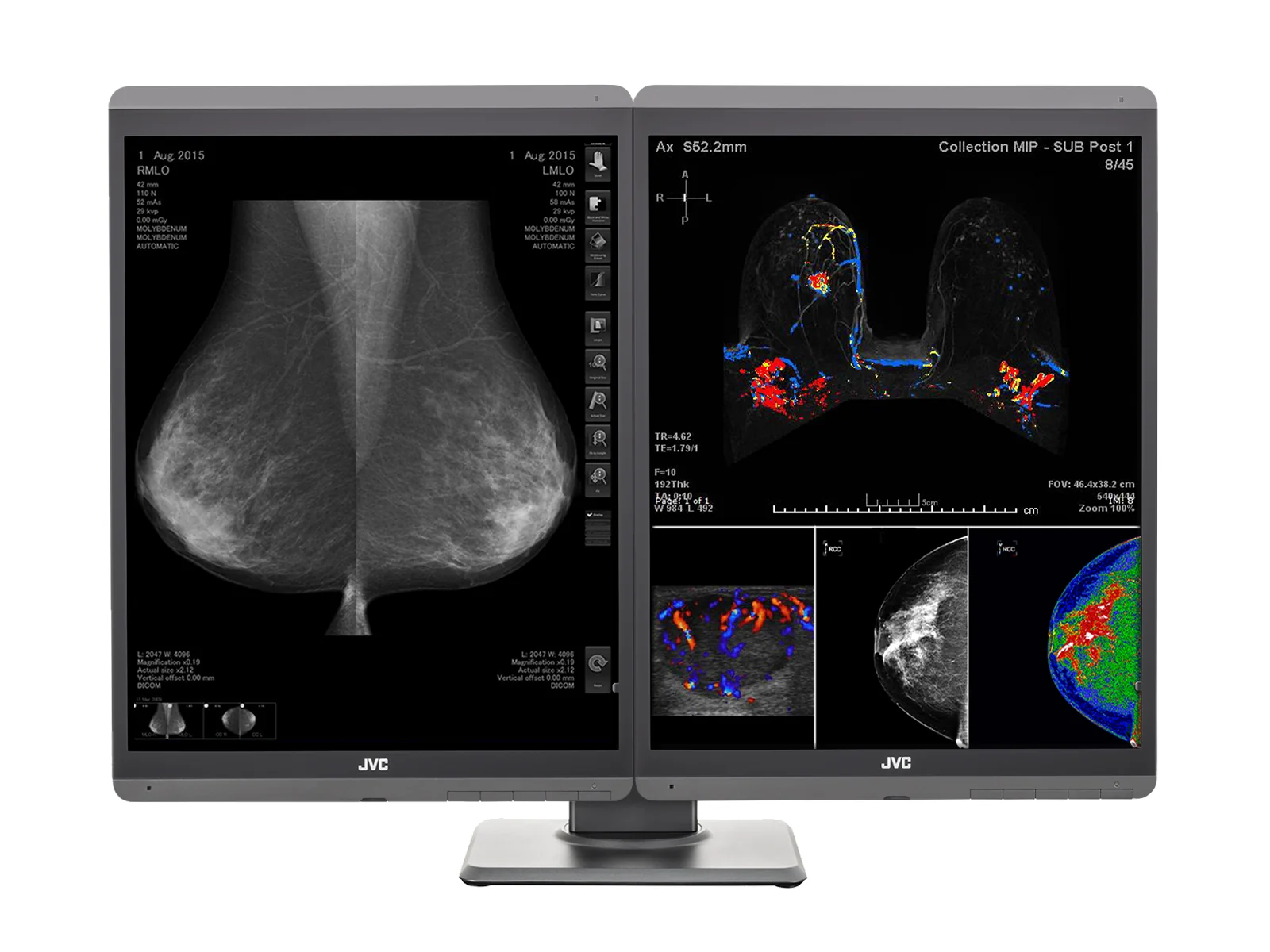 JVC Totoku CL-S500 5MP 21" Color Mammo 3D-DBT Breast Imaging Display (CL-S500) - Image 12