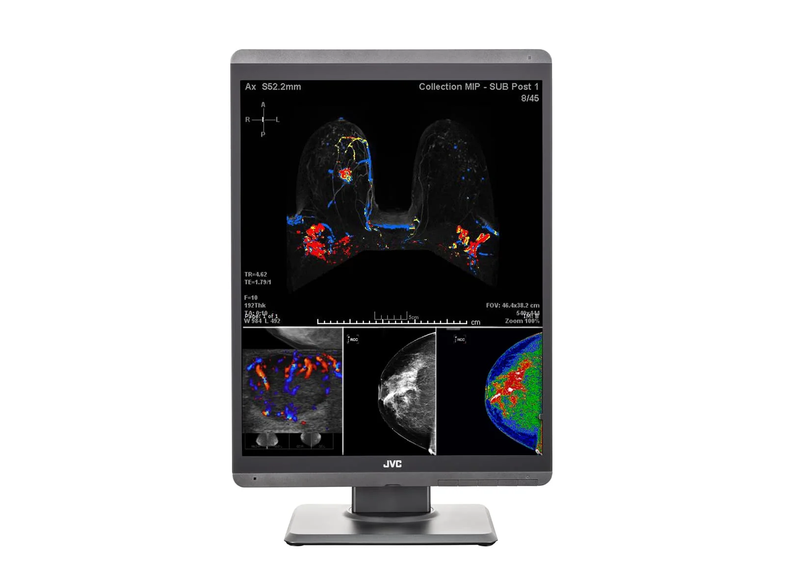 JVC Totoku CL-S500 5MP 21" Color Mammo 3D-DBT Breast Imaging Display (CL-S500) - Image 5