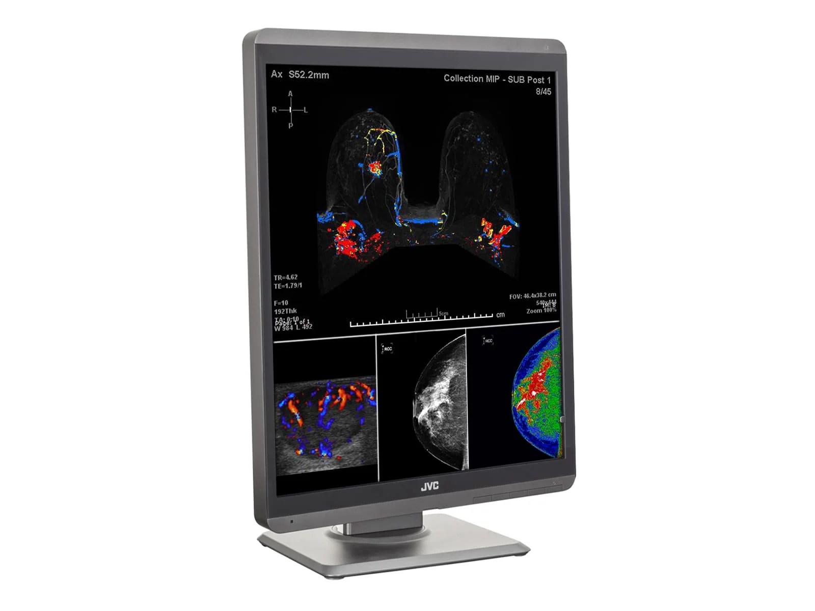 JVC Totoku CL-S500 5MP 21" Color Mammo 3D-DBT Breast Imaging Display (CL-S500) - Image 6