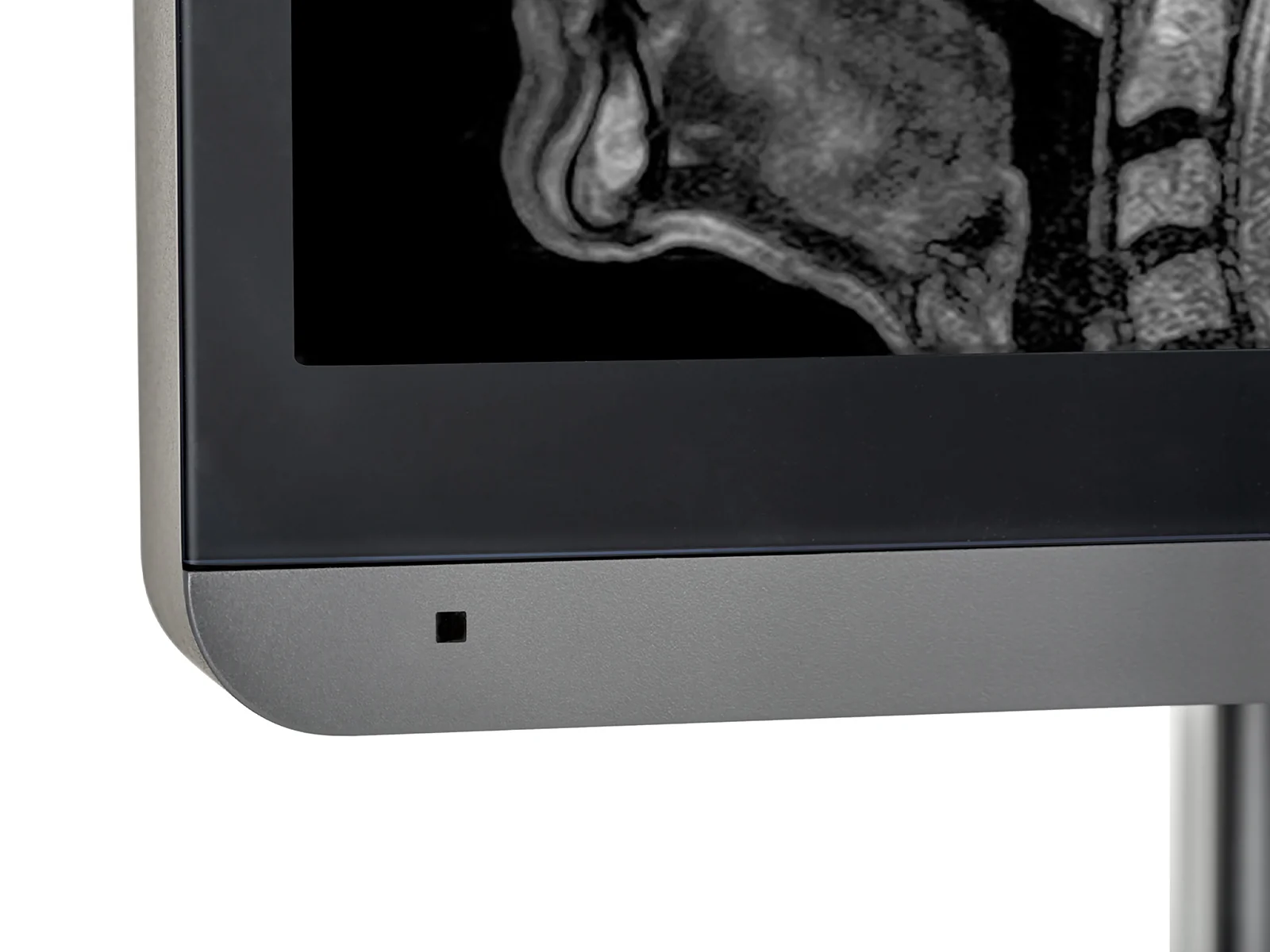 JVC Totoku MS-S200 2MP 21" Grayscale Diagnostic Radiology Display Monitor (MS-S200) - Image 9