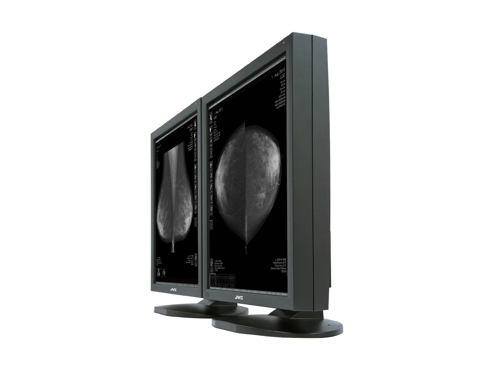 JVC Totoku MS55i2 5MP 21" Color LCD Mammo 3D-DBT Breast Imaging Display (MS55i2) - Image 2