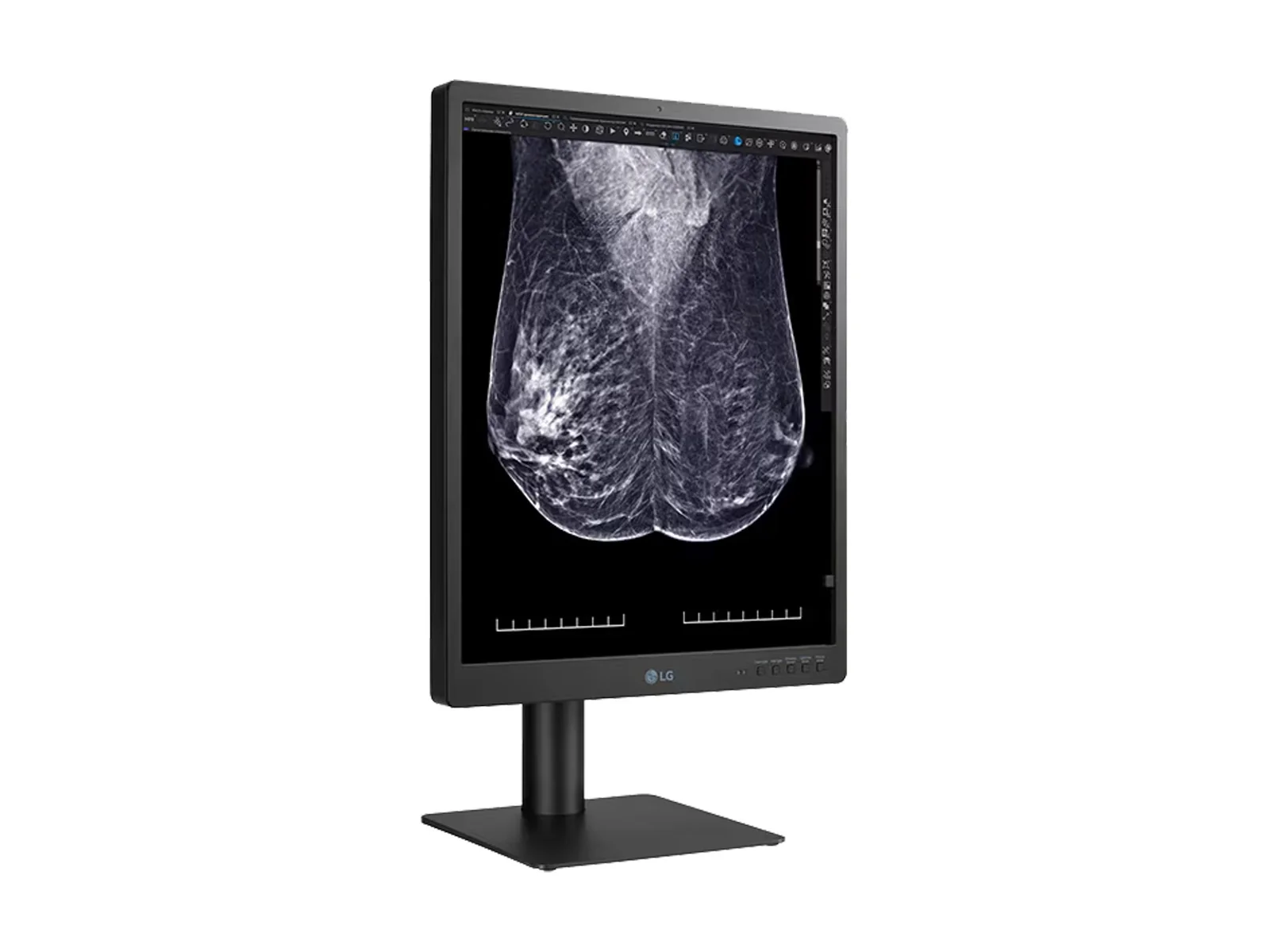 LG 5MP 21" 21HQ613D-B Color Mammography 3D-Tomosynthesis Breast Imaging Display Monitor - Image 10