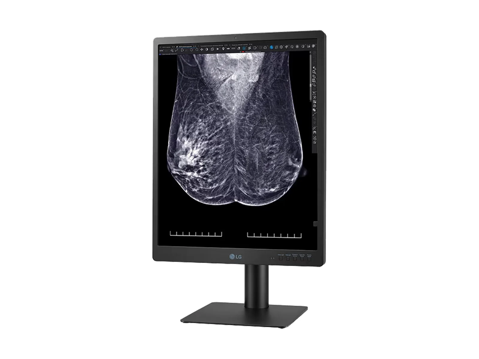 LG 5MP 21" 21HQ613D-B Color Mammography 3D-Tomosynthesis Breast Imaging Display Monitor - Image 8