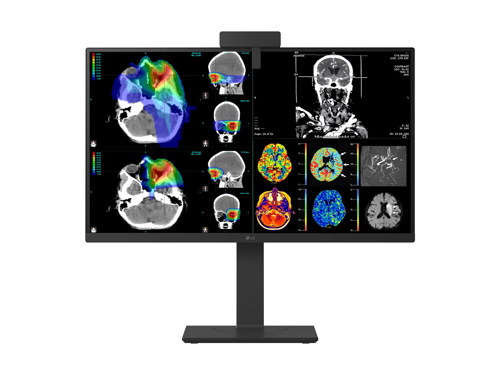 LG 27" 27HS713C Fusion 8MP 4K Clinical Review Medical DICOM Display Monitor - Image 7